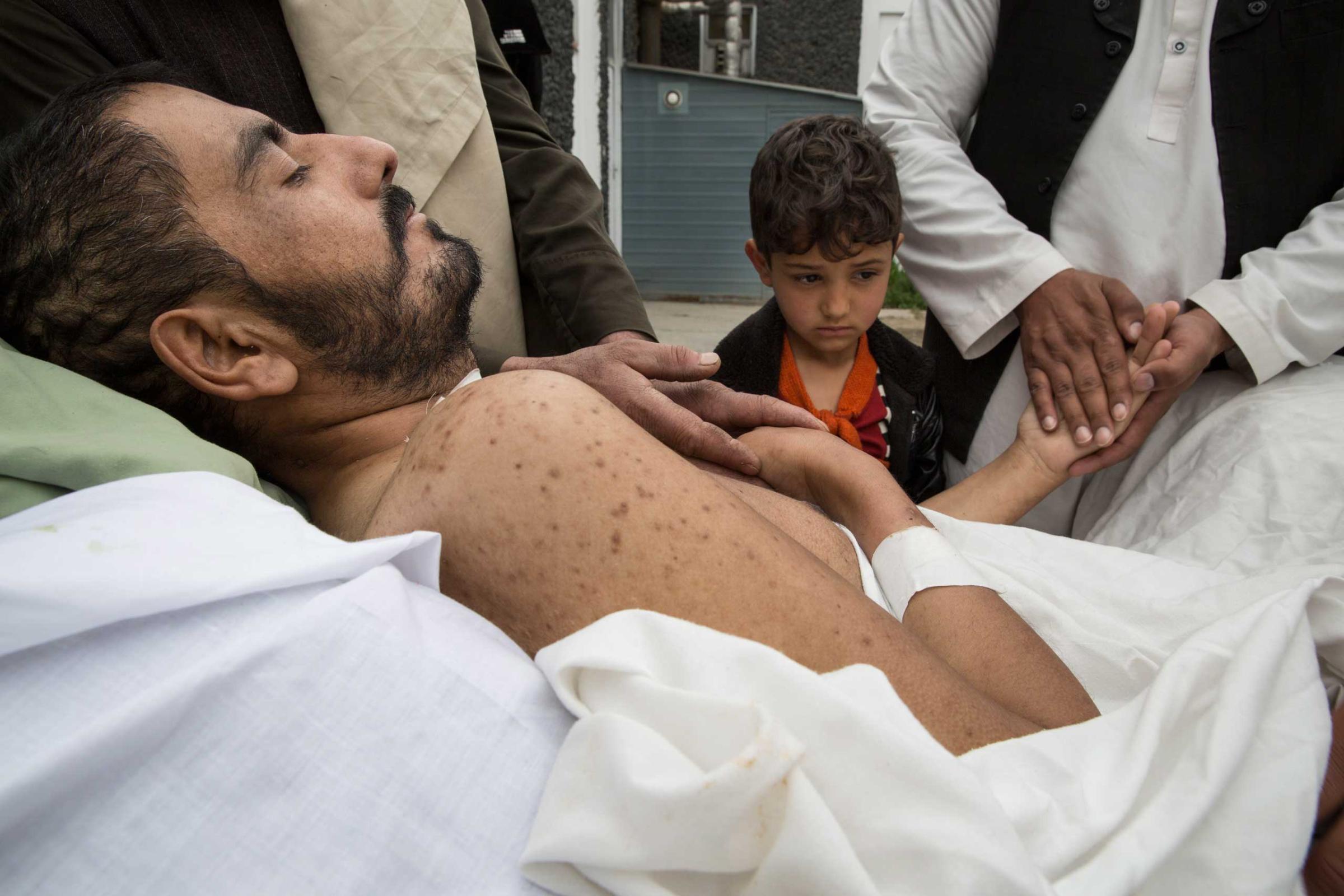 Khair Mohammed, 35, a paraplegic, lays in bed outside his ward as friends and relatives—including his daughter, Madina, 6—visit him at the emergency hospital in Kabul on March 28, 2016. Mohammed had barely escaped death after taking 3 bullets to his abdomen and skull.