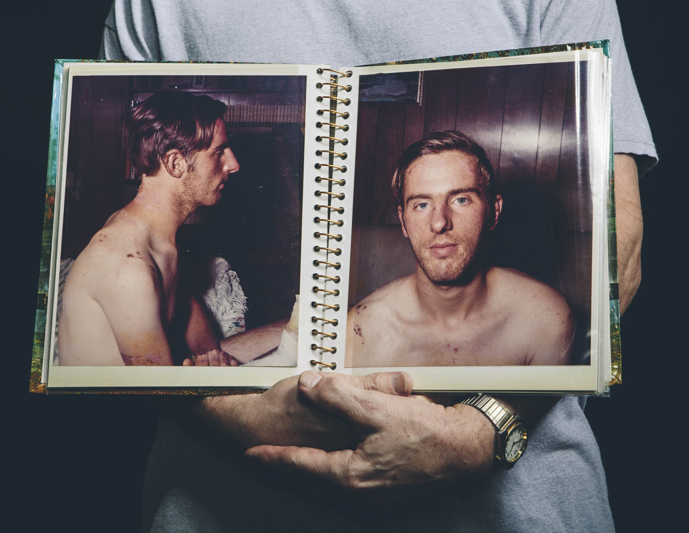 Francis Dufresne holding a photo album documenting his recovering from burns he suffered during the 1973 fire at the Upstairs Lounge in New Orleans, LA.