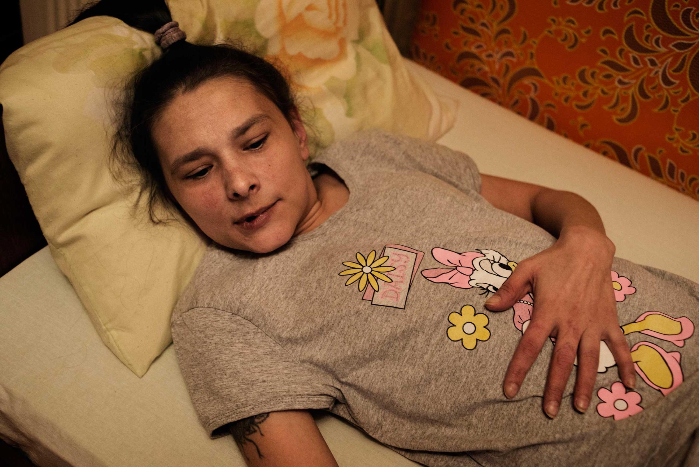 Oxana has been lying in bed for the past one year and half with her back permanently damaged. The high use of Krokodil damaged her mussels and her spine. Despite several surgeries she can't seat or stand. Her condition has also been worsened by her father's beatings who couldn't cope with her constant request for money to buy drug.