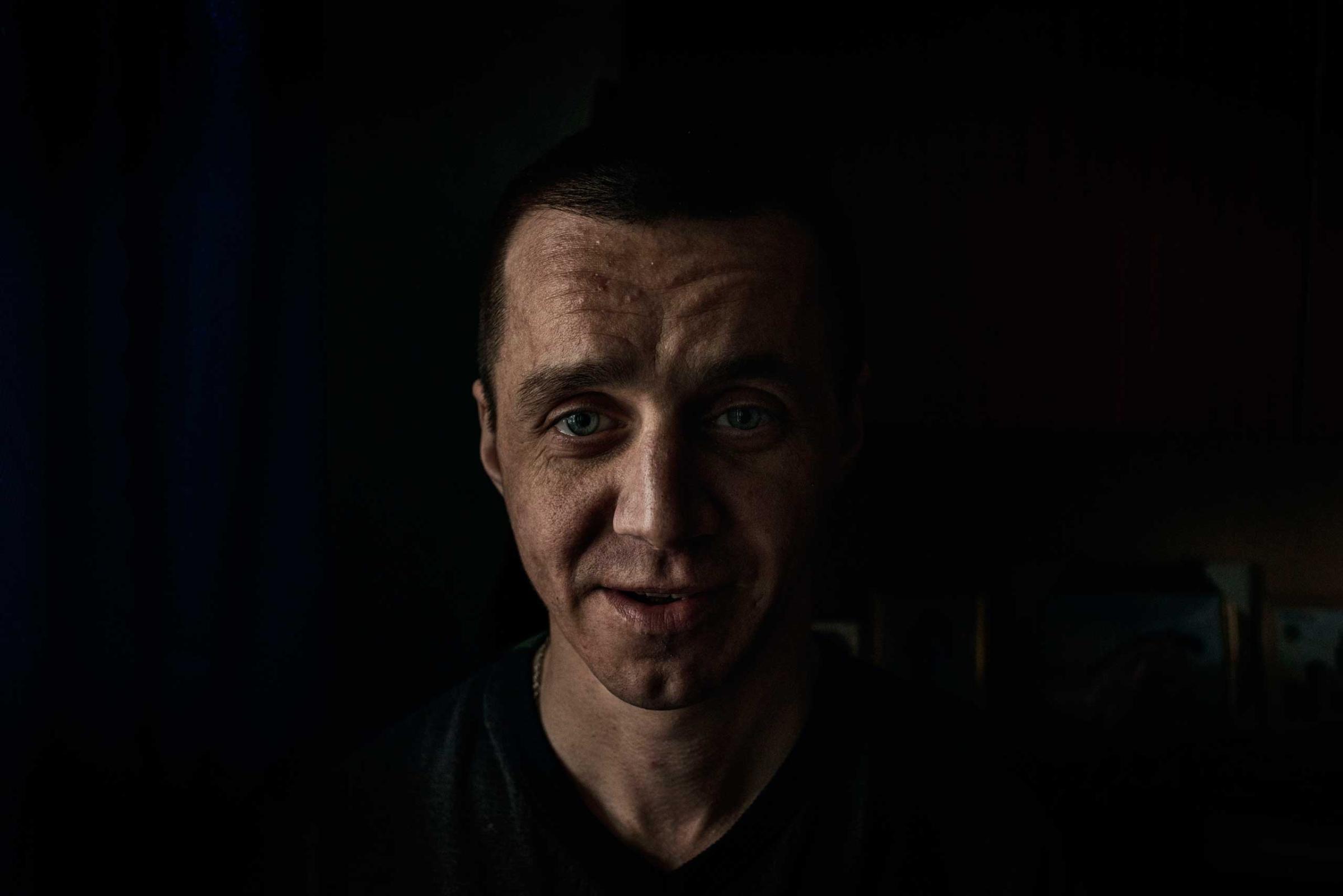 Pavel, a former krokodil user, quit completely to take drugs about two years ago. According to him after he was close to die for the third time in his life.