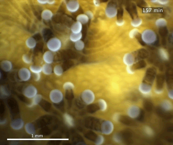 Benthic Underwater Microscope