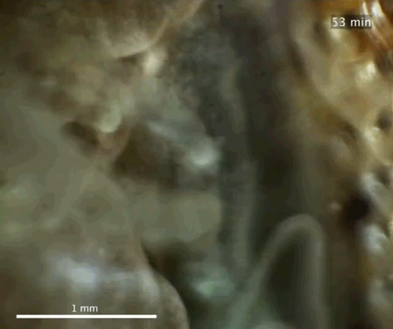Benthic Underwater Microscope