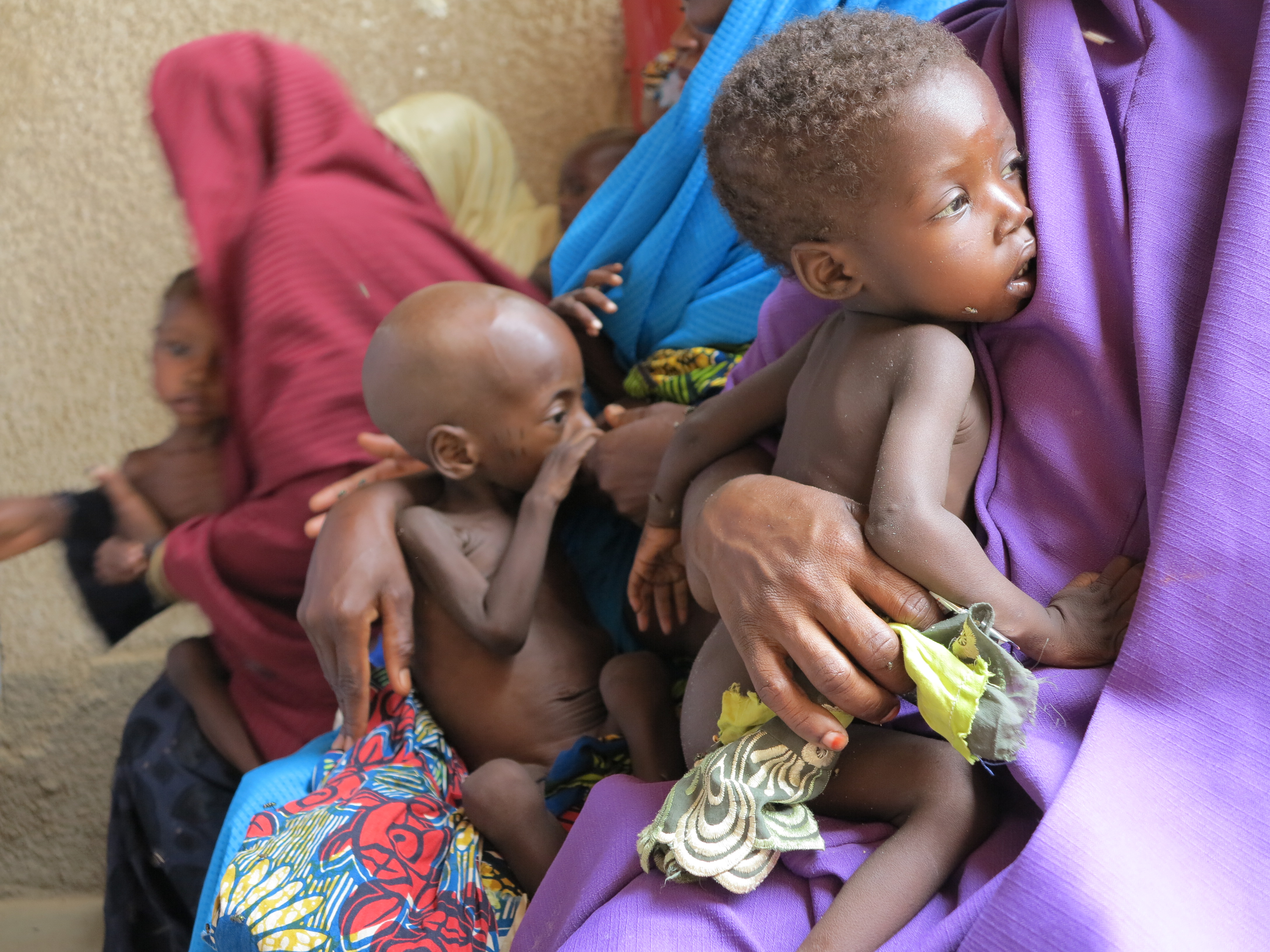 Yahya Abdumalik, a 14-month-old severely malnourished child held by his mother, Zayha Arouna, at a clinic in Madarounfa, a village in Niger near the Nigerian border on June 14, 2012 (The Washington Post—Getty Images)