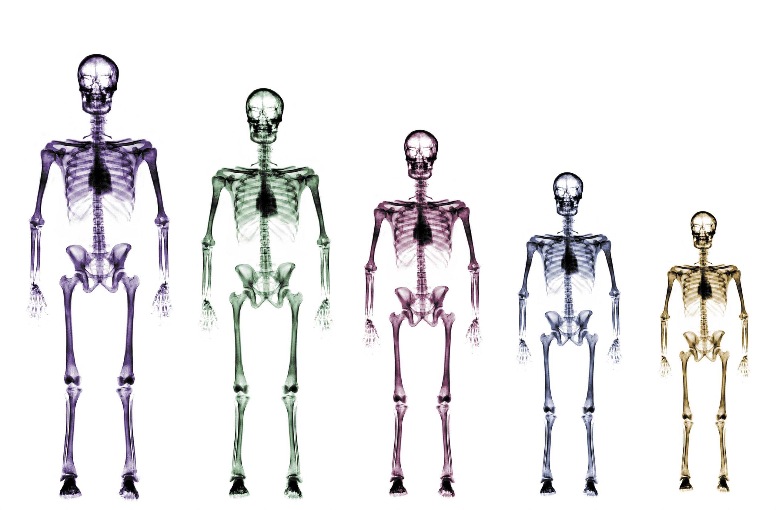 Skeleton growth chart