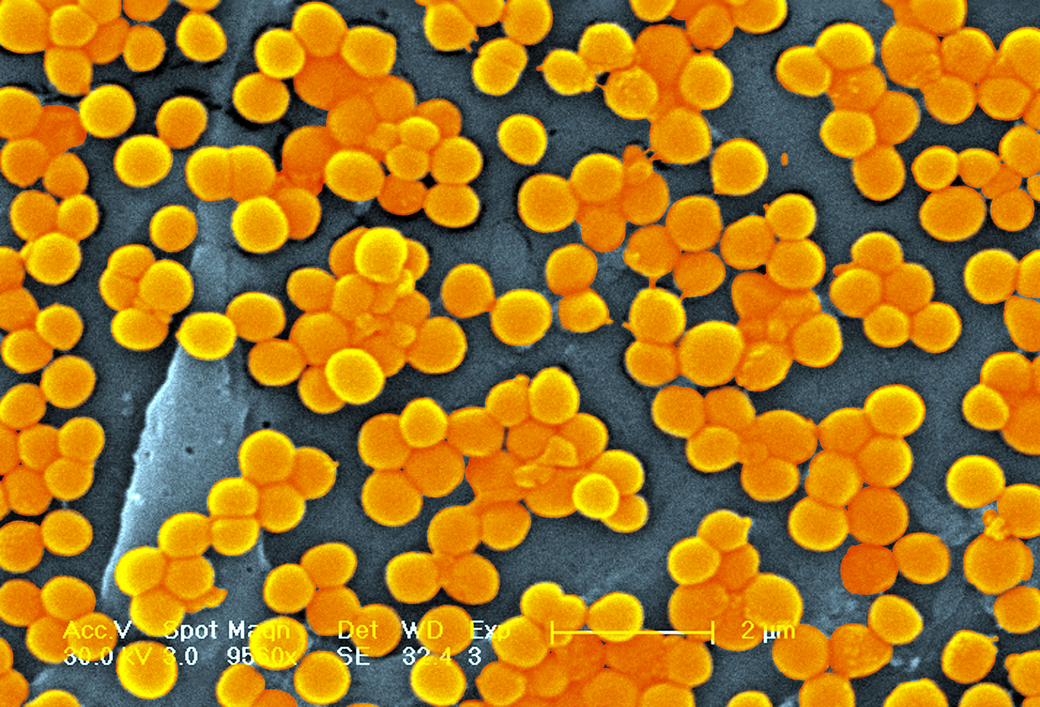 Methicillin-Resistant Staphylococcus Aureus (MRSA). (BSIP&mdash;UIG via Getty Images)