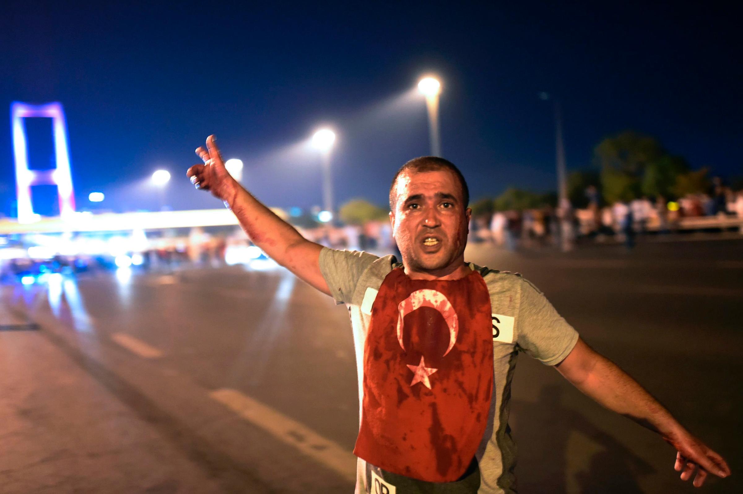 A man covered with blood points at the Bosphorus Bridge as the Turkish military clashes with people at the entrance to the bridge in Istanbul on July 16, 2016.