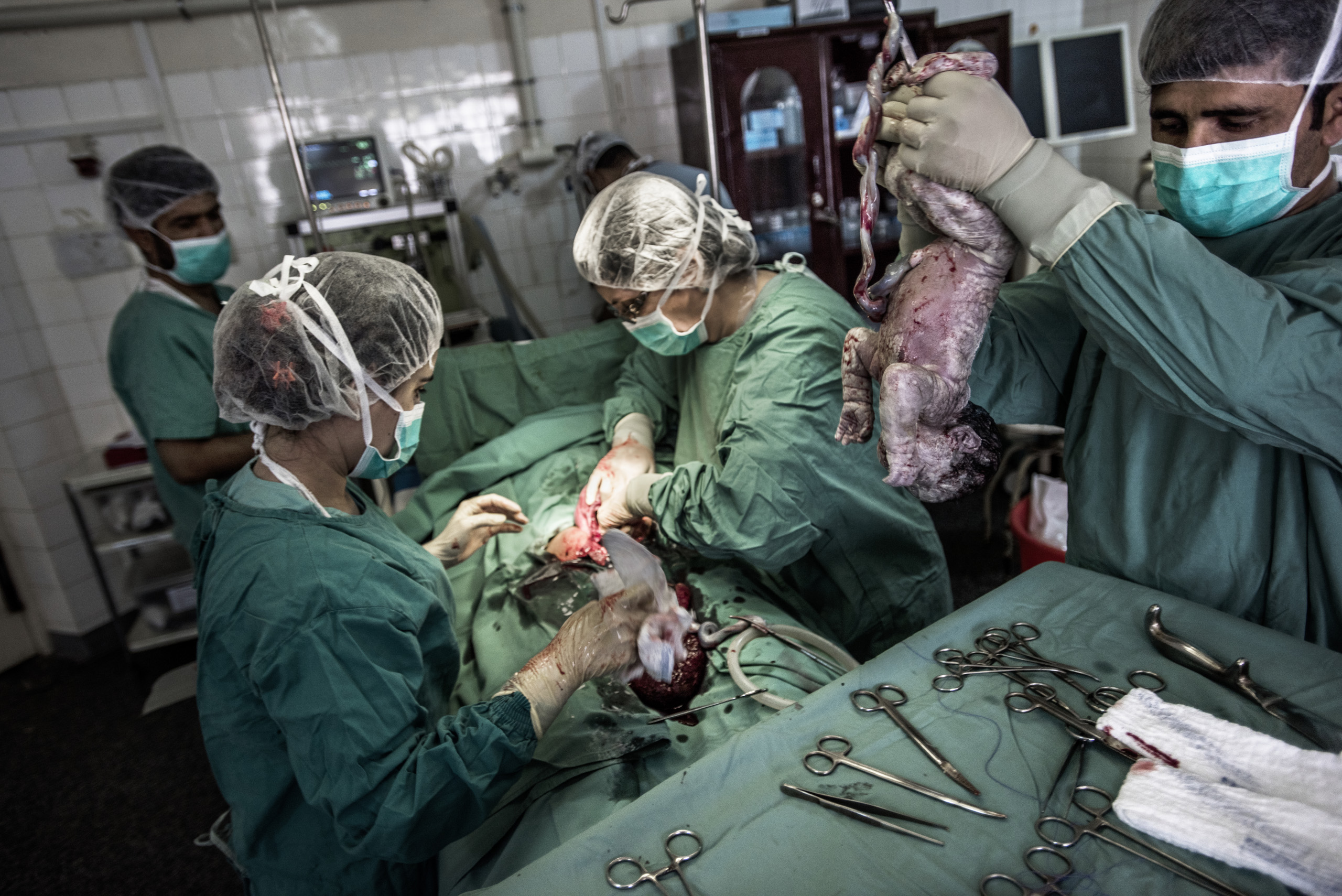 A cesarean section at the operating theatre in  a Doctors Without Borders hospital, Lashkar Gah, Helmand, Afghanistan, June 2016.