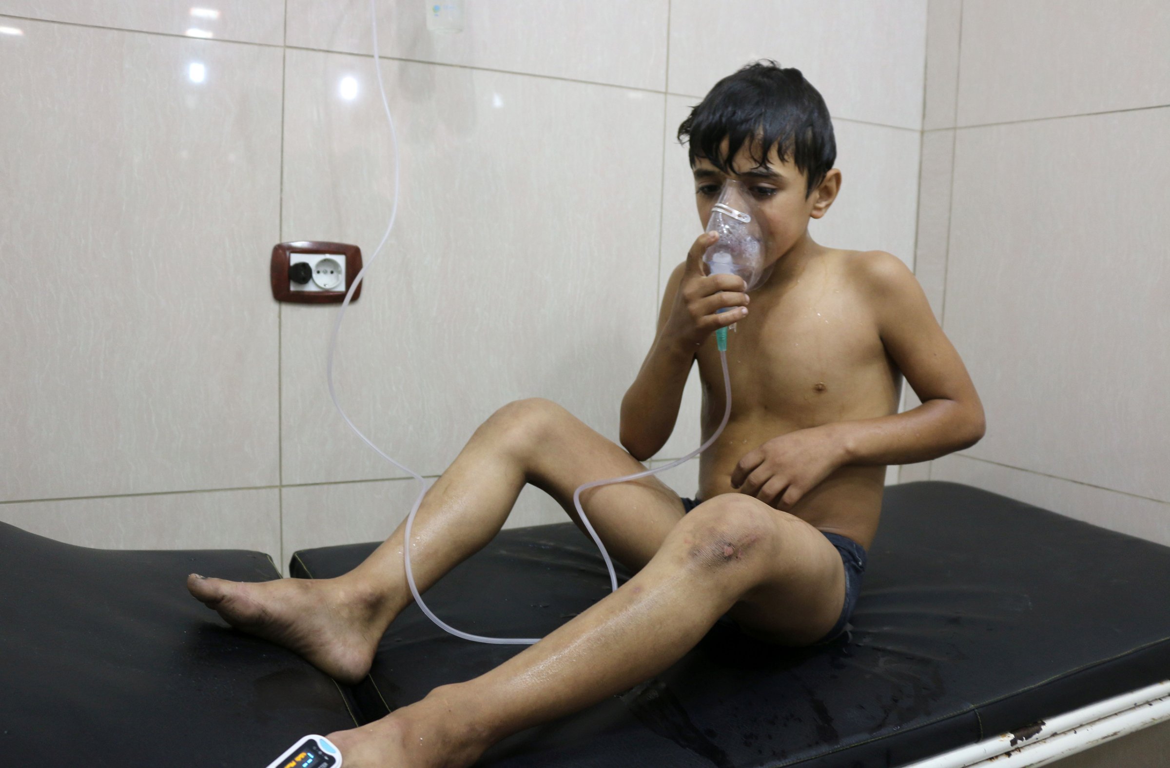 A Syrian boy suffering from breathing difficulties is treated at a makeshift hospital after regime helicopters dropped barrel bombs on the rebel-held Sukari neighborhood of Aleppo on Sept. 6, 2016. The Britain-based Syrian Observatory for Human Rights said more than 70 people—"most of them civilians"—were treated for choking symptoms.