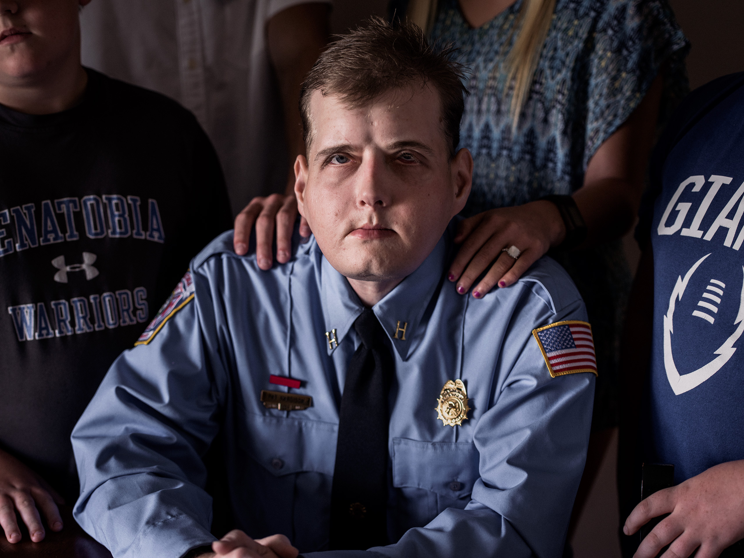 Patrick Hardison, 42, received the most extensive face transplant ever, after suffering massive burns as a volunteer firefighter.From  The New Transplant Revolution.  Sept. 5, 2016 issue.