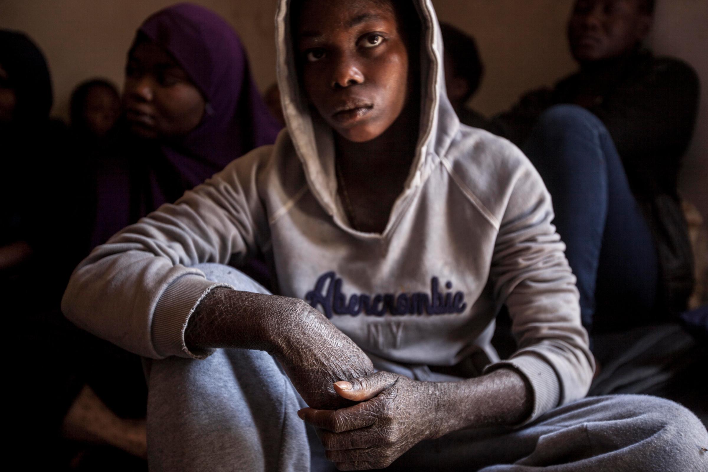 A young woman migrant suffering from scabies sits in the female section of a detention center in Surman, Libya.