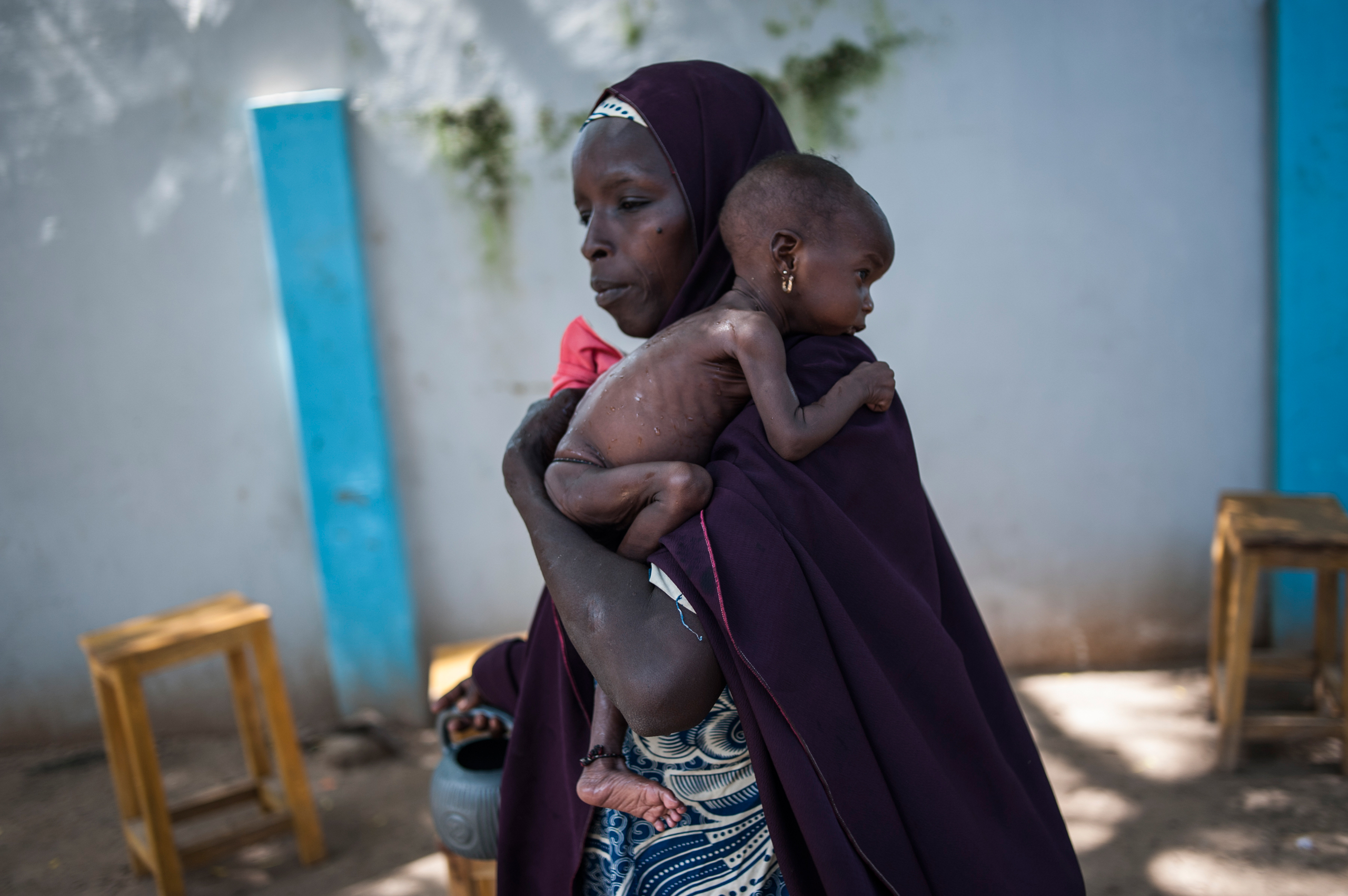 A mother holding her young malnourished baby at a public health facility in the Dalaram district of Maiduguri, Nigeria, on Sept. 15, 2016. (Stefan Heunis—AFP/Getty Images)