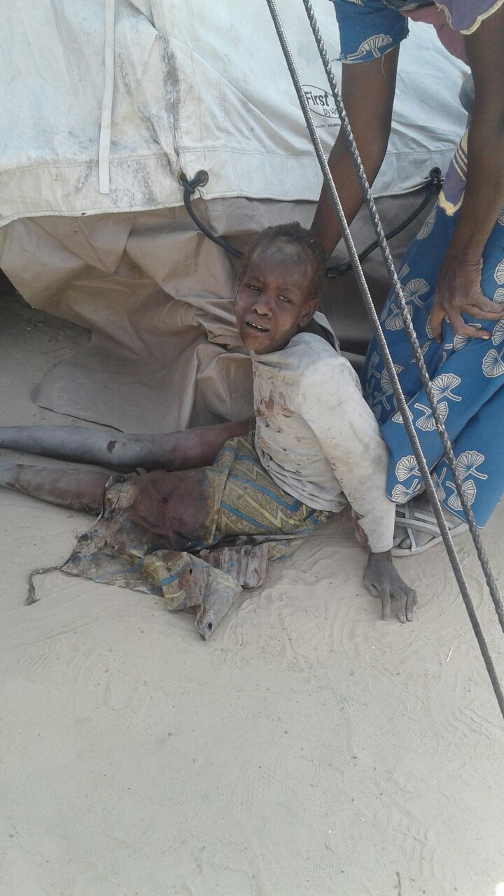 An injured children after an attack on a camp for internally displaced people in Rann, Nigeria, on Jan. 16.