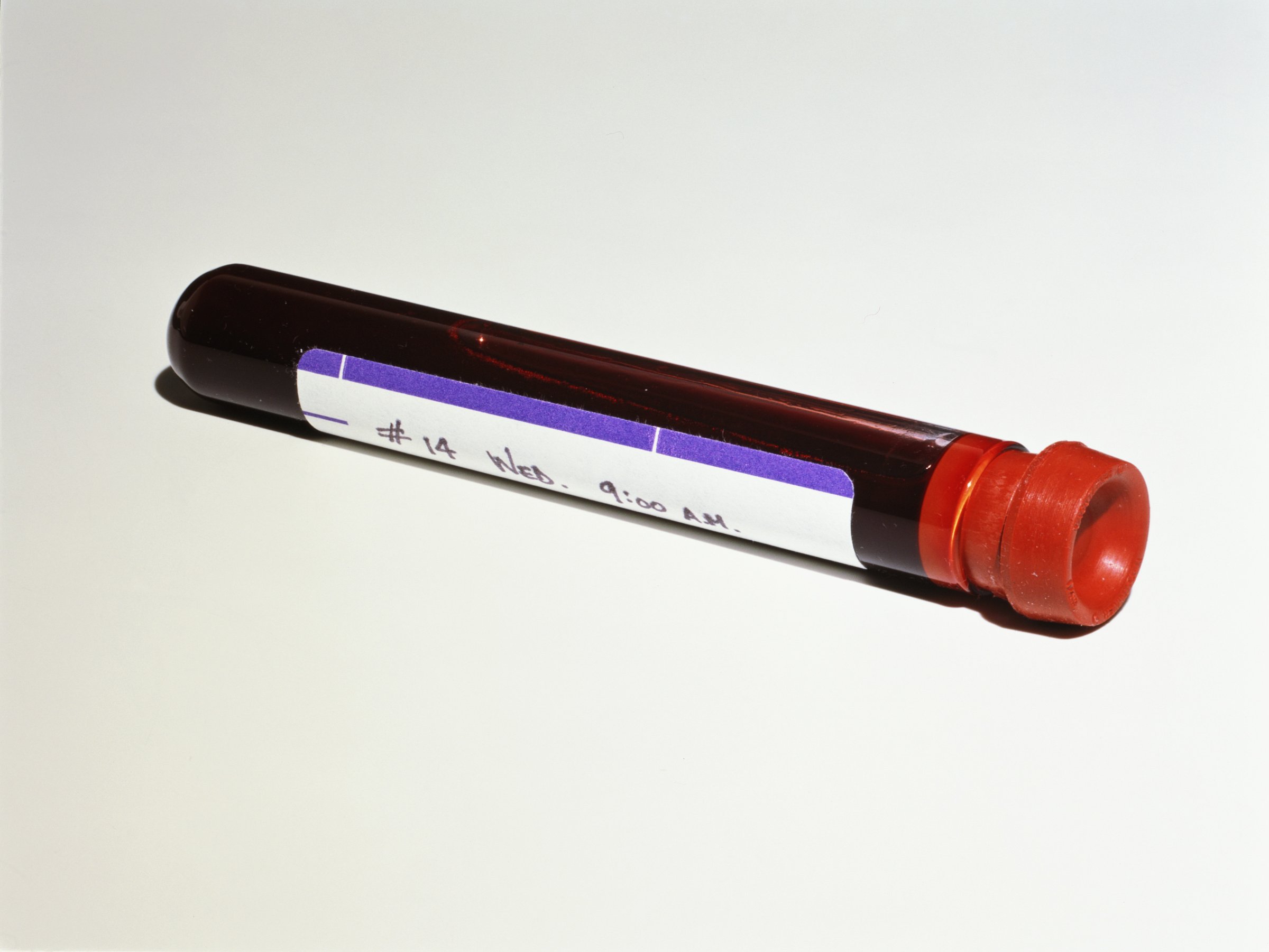Blood sample in vial, against white background, close-up