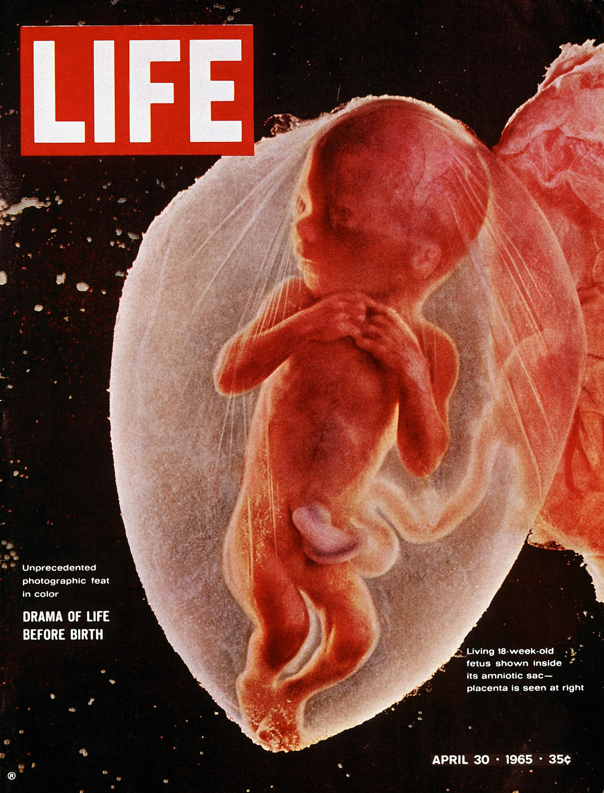 The cover of LIFE Magazine features a photograph of an 18-week-old fetus inside its amniotic sac, April 30, 1965. (Lennart Nilsson—LIFE Magazine)
