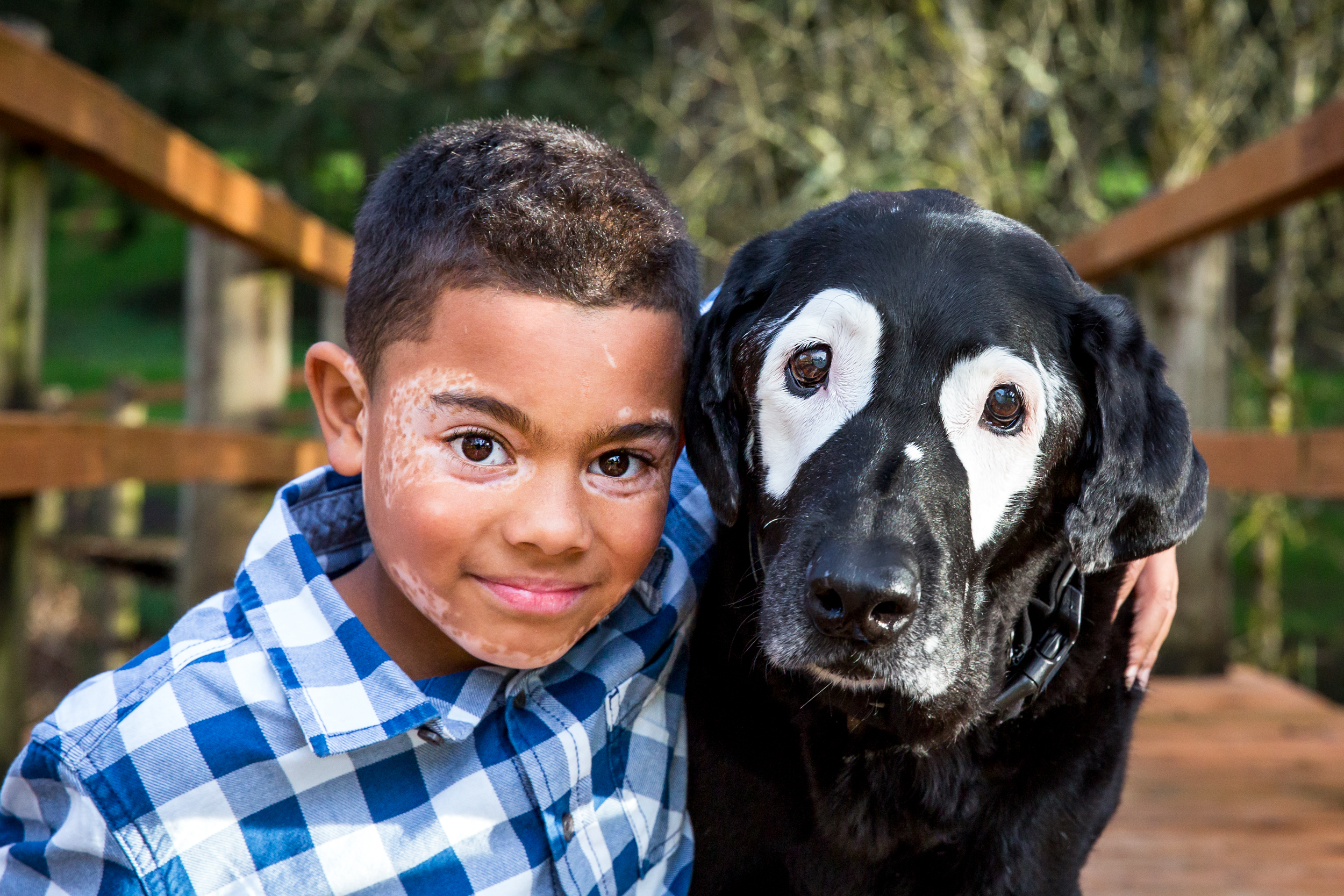 Carter Blanchard, of Arkansas, is pictured here with his new friend Rowdy. Both were diagnosed with Vitiligo, a rare skin disorder. (Lindsay Hile / Sit! Stay Pet Photography)