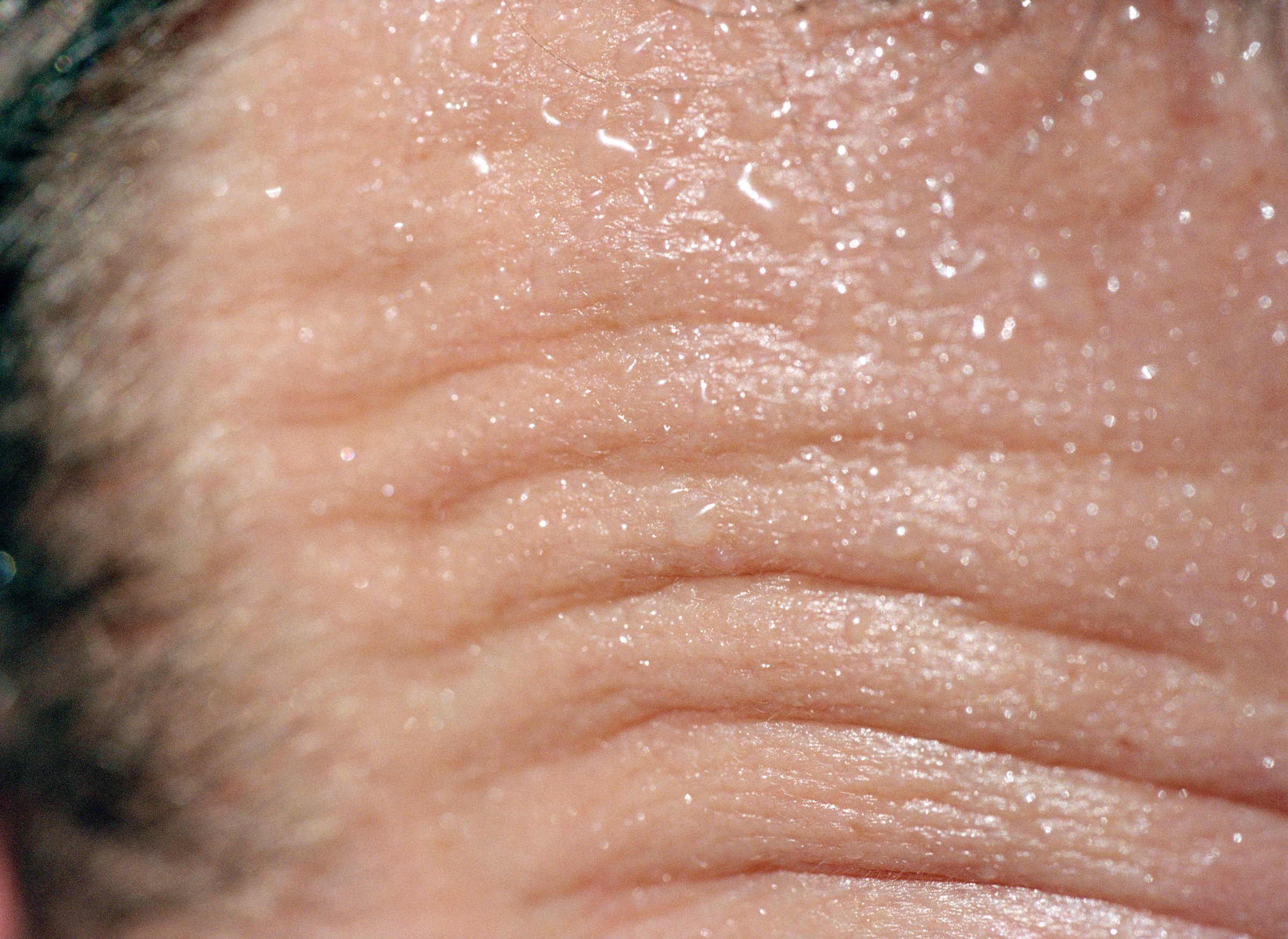 Close-up of man's wrinkled forehead TIME health stock