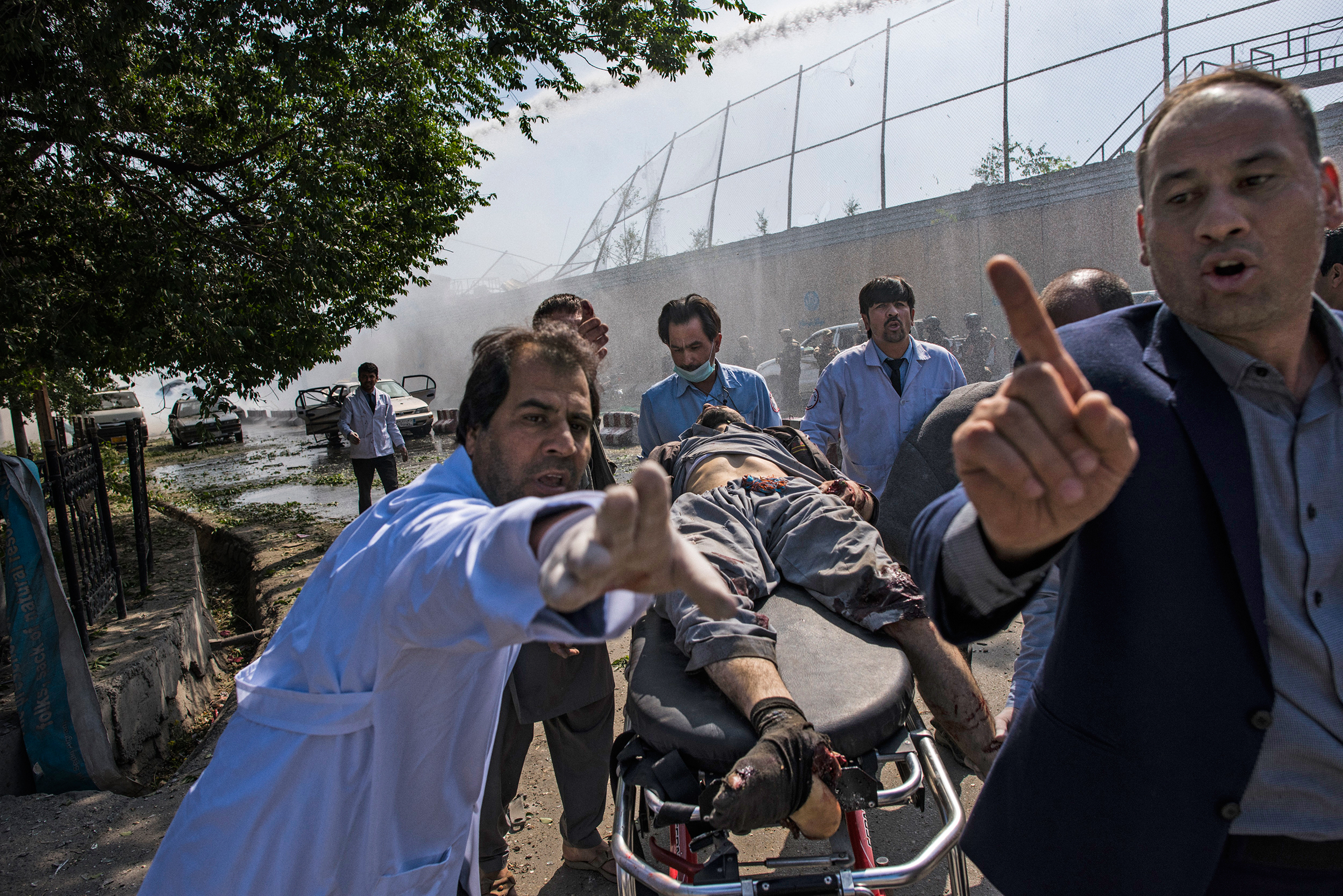 An injured man is carried to an ambulance after the May 31 blast in Kabul that left at least 90 dead (Andrew Quilty)