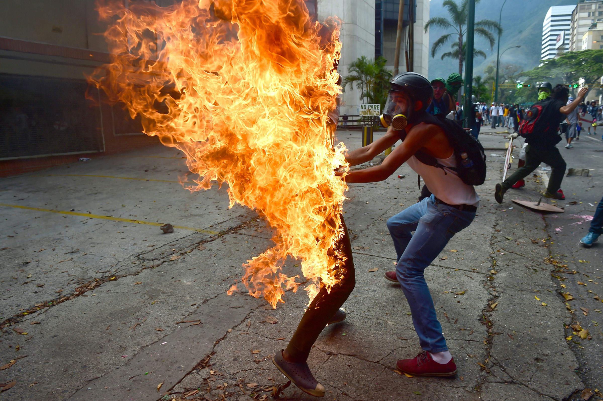 A demonstrator lifts the shirt off of a man who was accidentally set ablaze in Caracas on May 3, 2017.