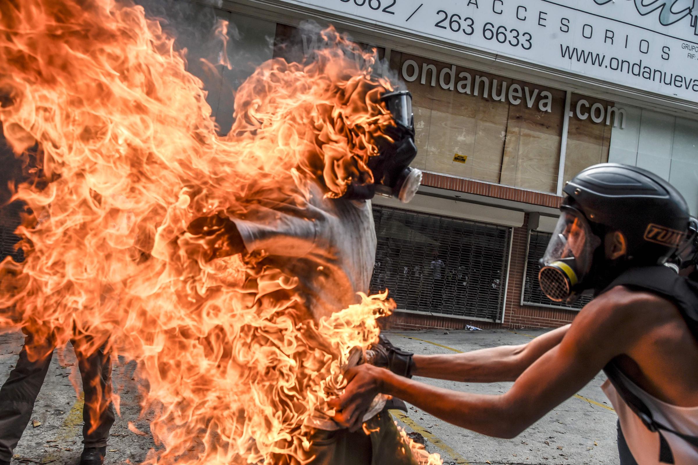 A demonstrator lifts the shirt off of a man who was accidentally set ablaze in Caracas on May 3, 2017.
