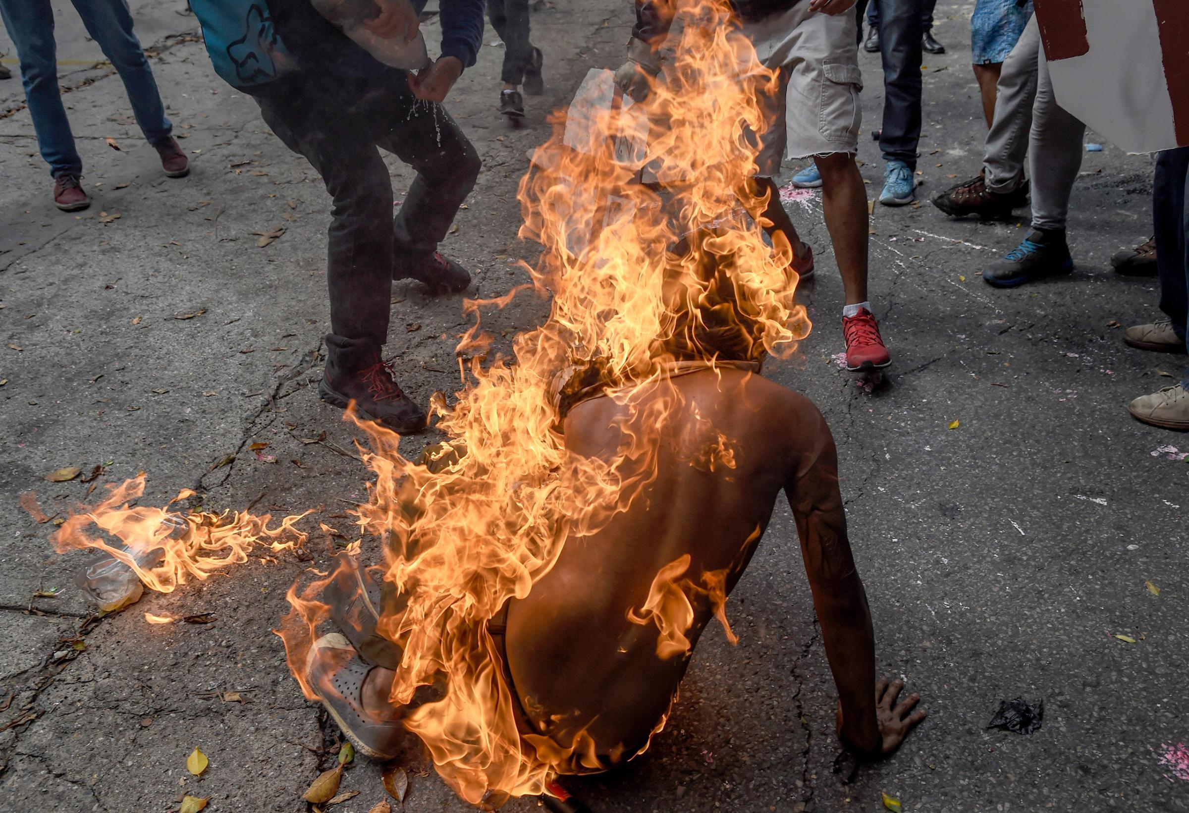 The man falls to the ground as others rush to his aid in Caracas on May 3, 2017.