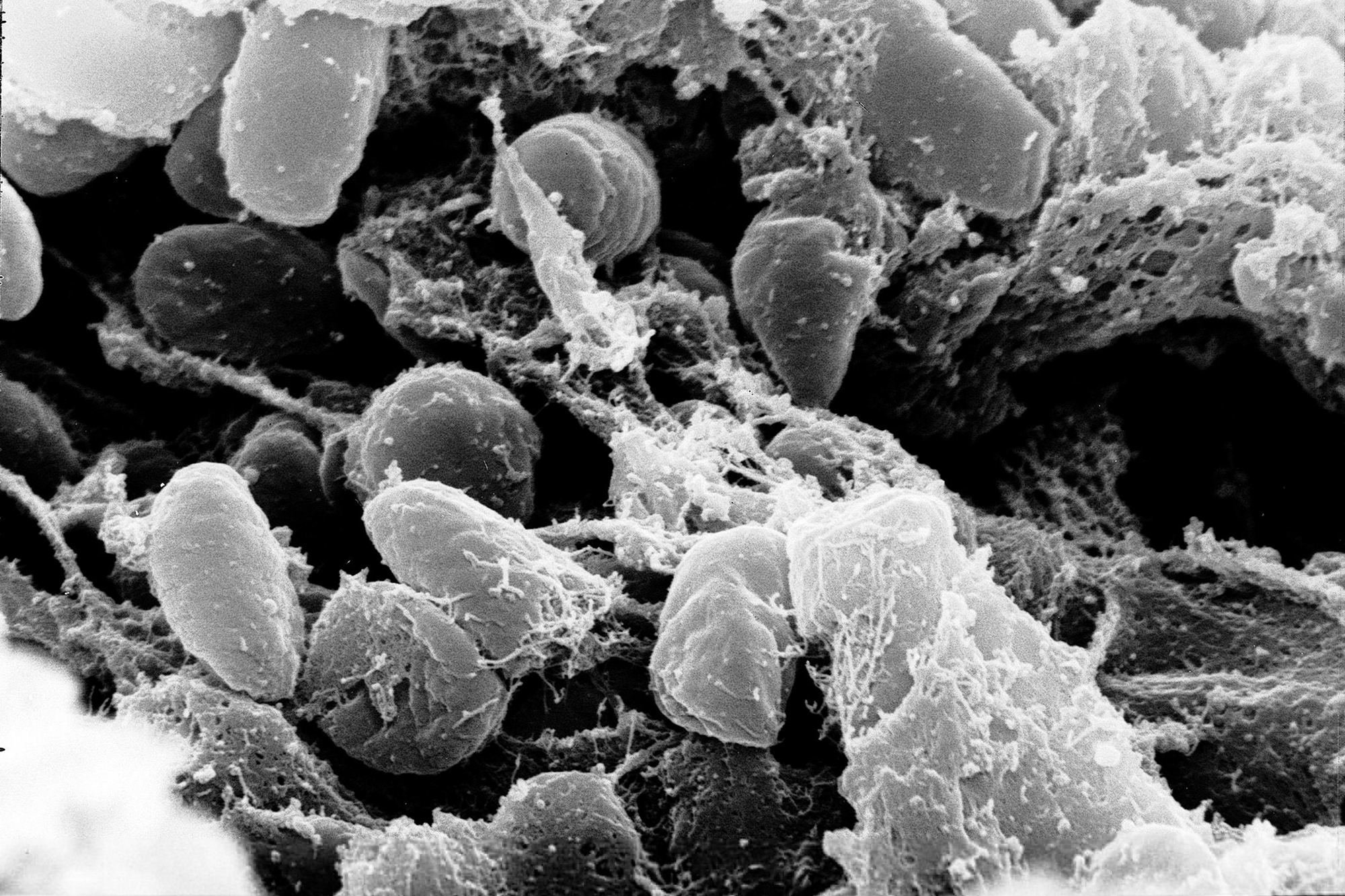 Mass of Yersinia pestis bacteria. (Media for Medical/UIG/Getty Images)