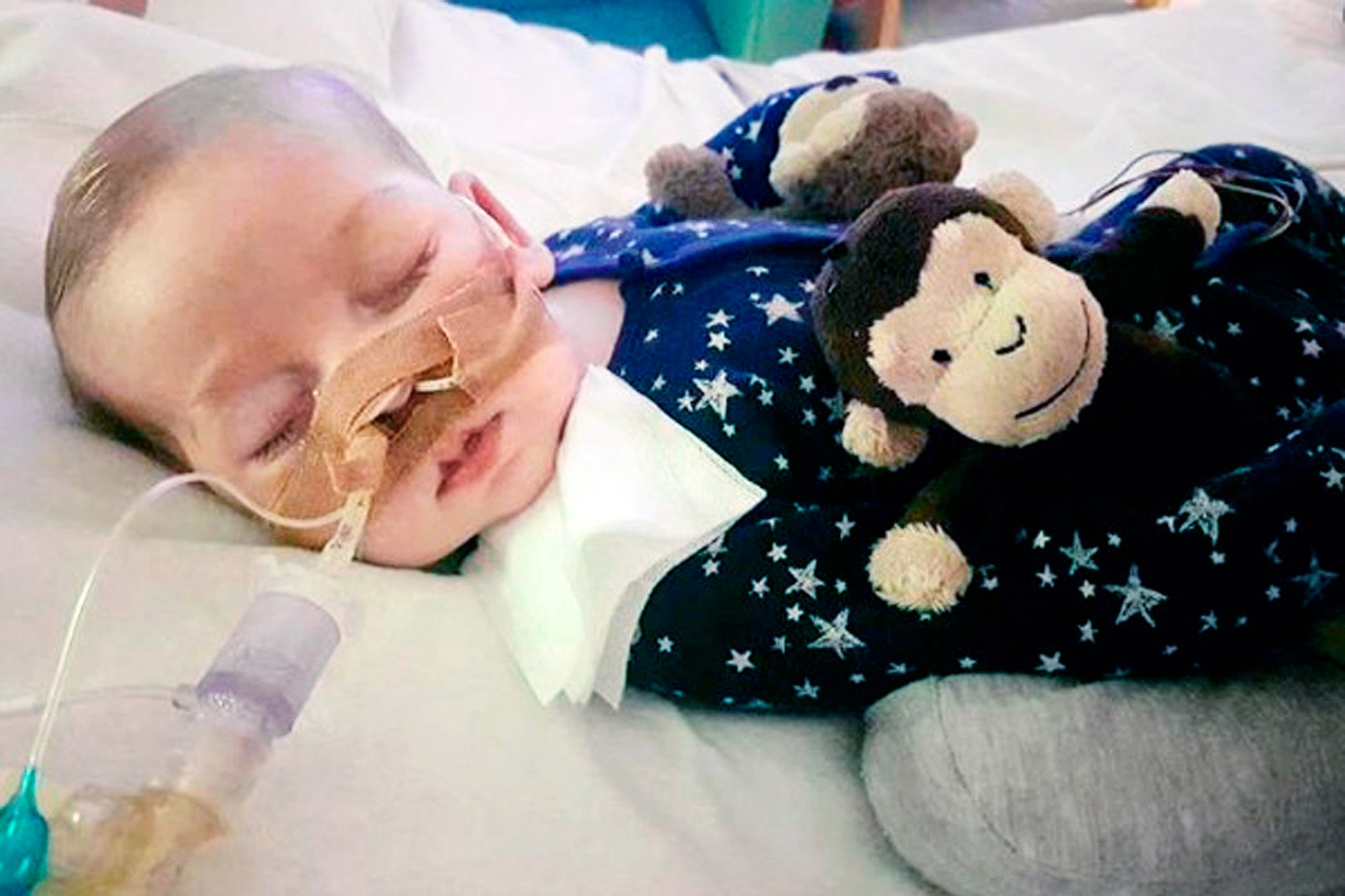 Charlie Gard’s parents are fighting doctors for the right to treat him with an experimental therapy