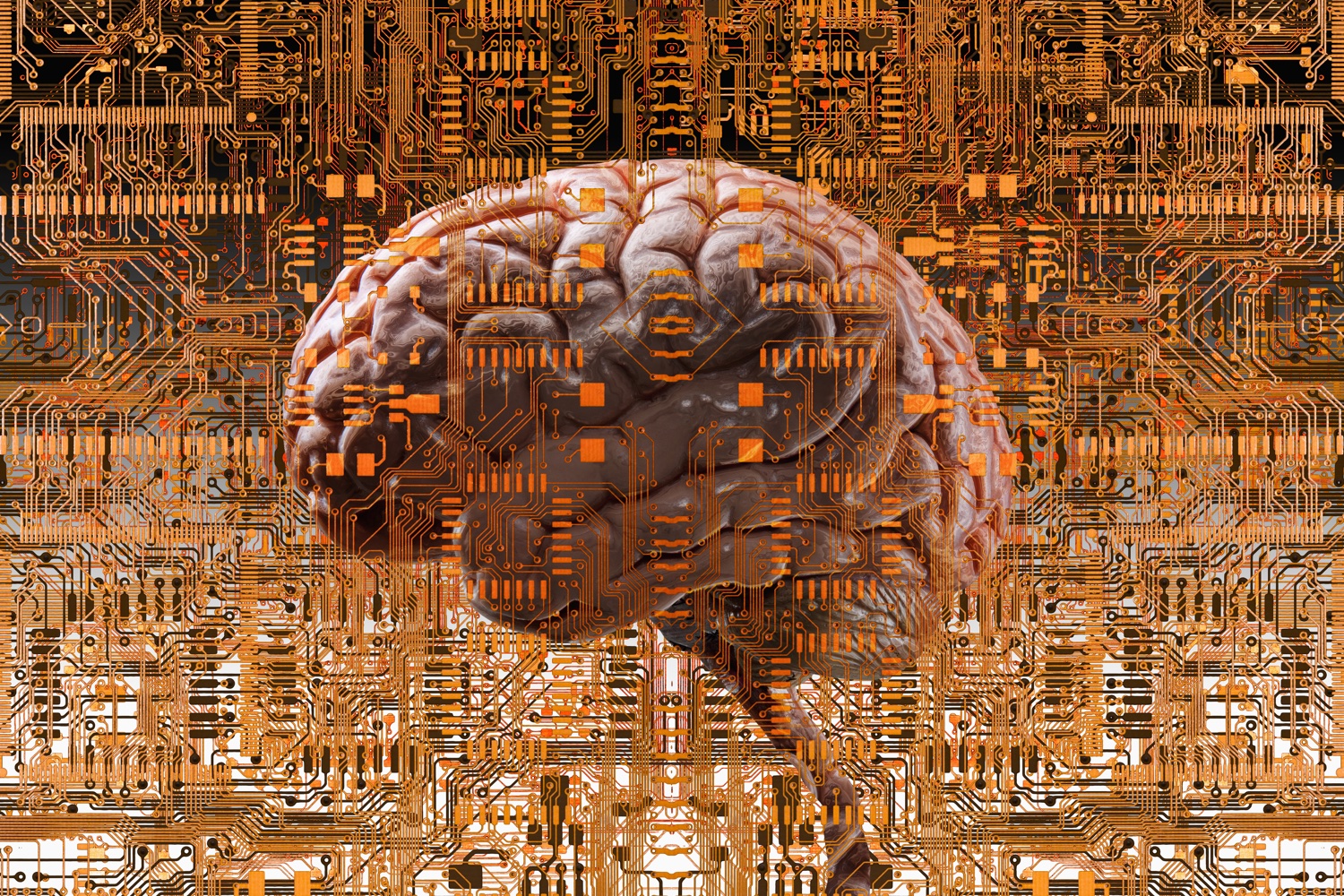 Brain under layers of circuit boards