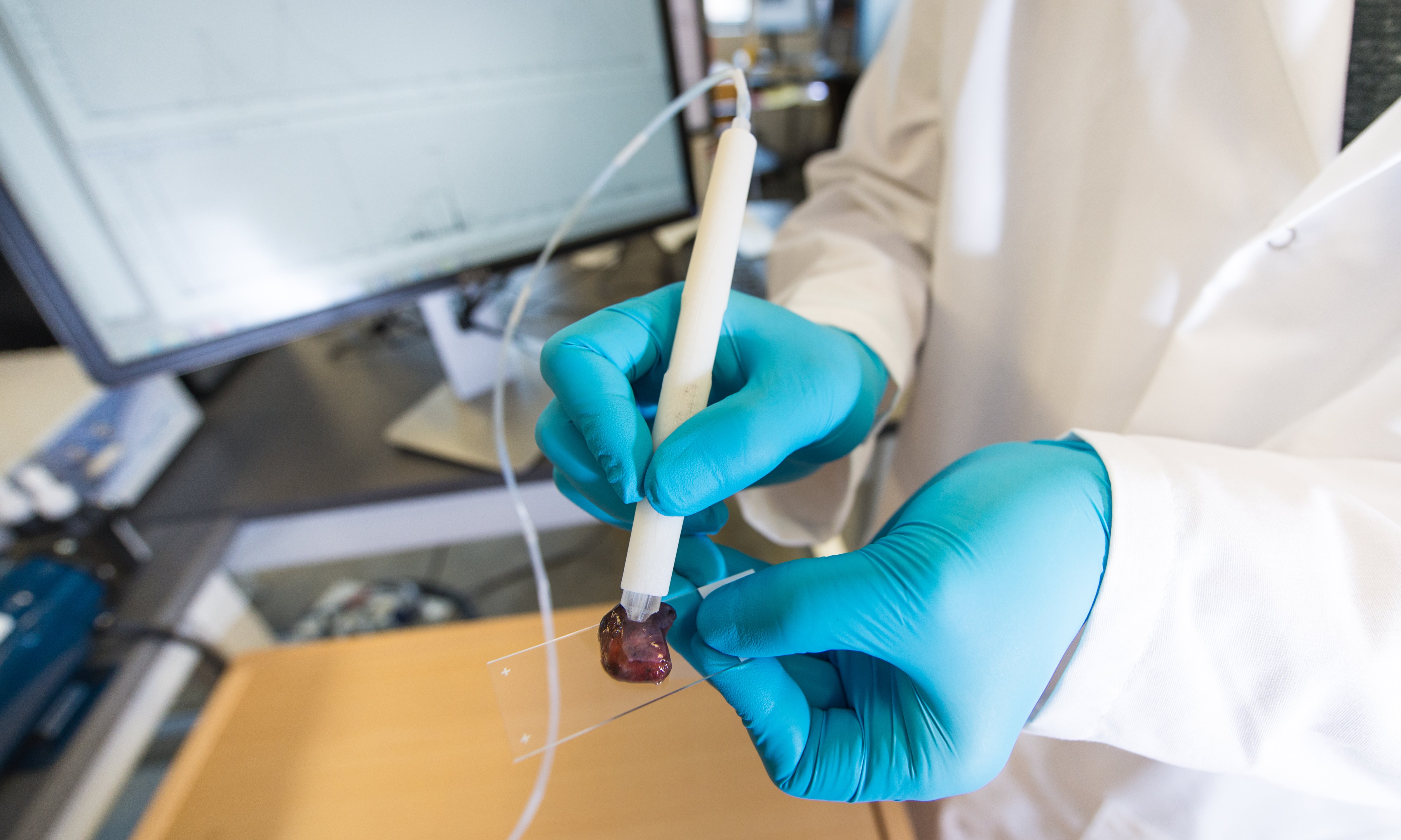 The MasSpec Pen is a handheld probe that can non-destructively analyze human tissue samples to identify cancer. (Vivian Abagiu/Univ. of Texas at Austin)