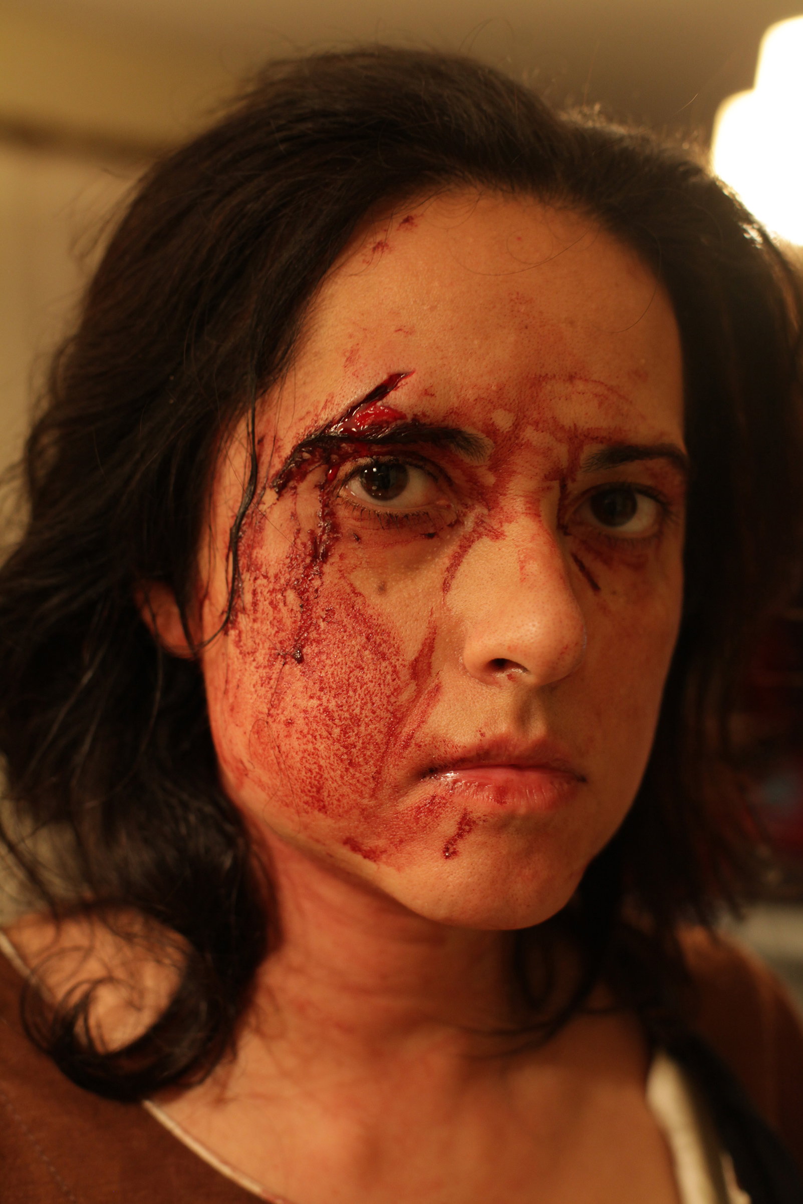 A self portrait by photojournalist Rena Effendi taken after an attack on March 9, 2012. (Rena Effendi)