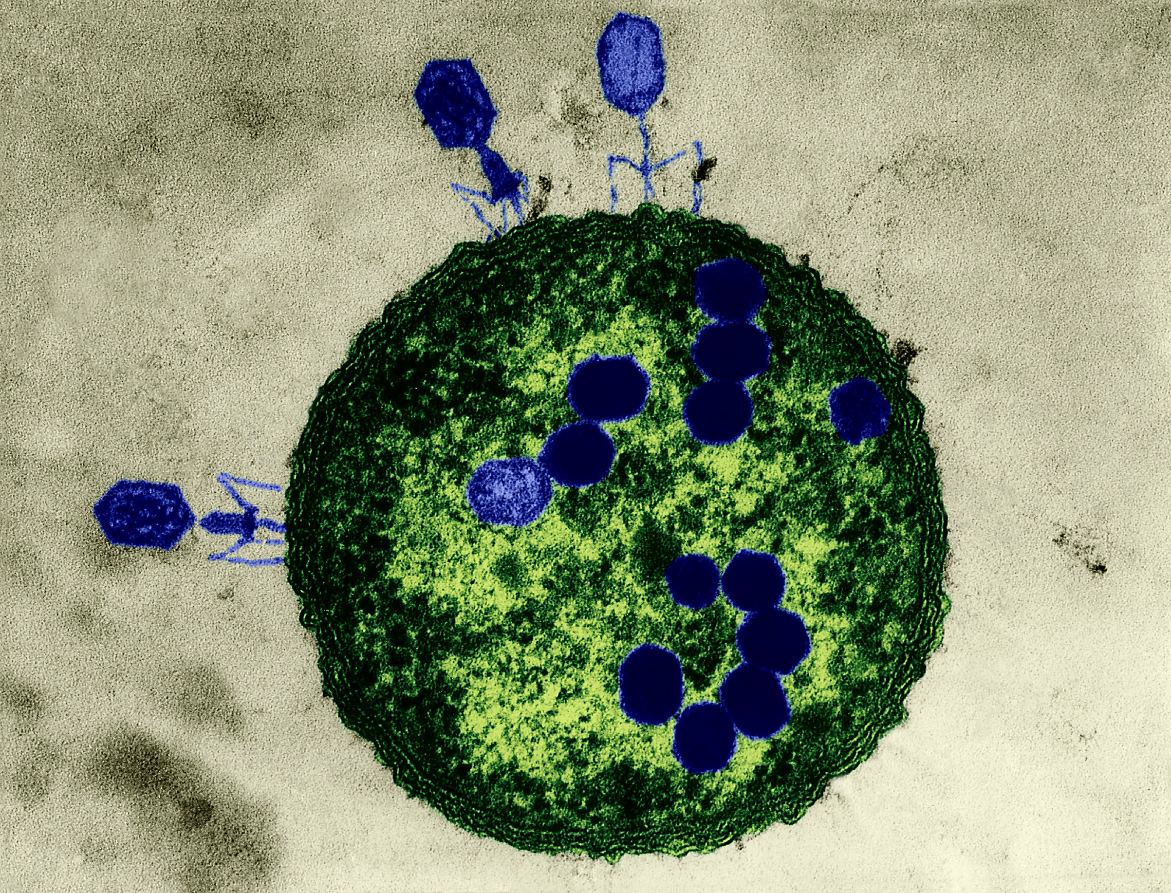 Bacteriophages, which are viruses, attack by invading and replicating inside drug-resistant bacteria, causing them to explode (D Simon Lee—;Getty Images/Science Source)