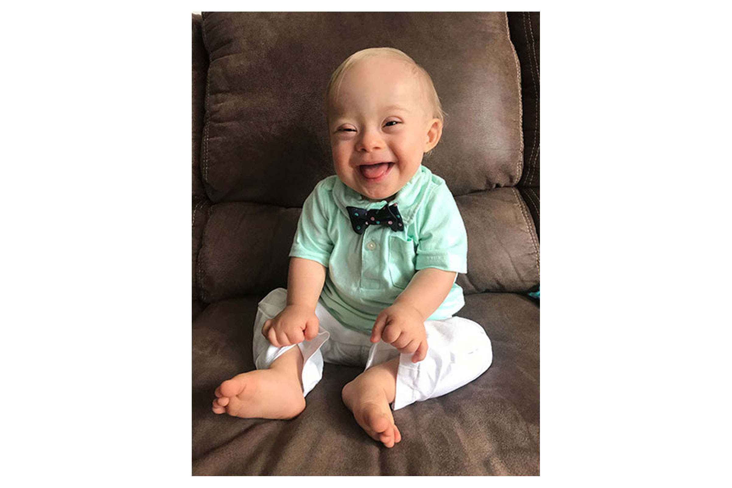 gerber baby with down syndrome