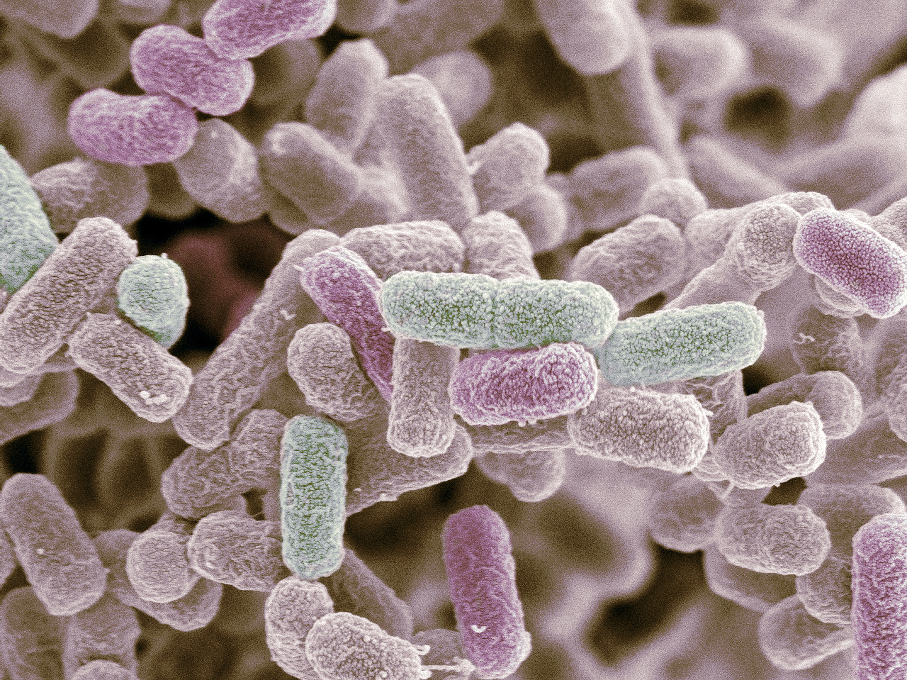 E. coli bacteria. Coloured scanning electron micrograph (SEM) of Escherichia coli bacteria. (STEVE GSCHMEISSNER—Getty Images/Science Photo Library RM)