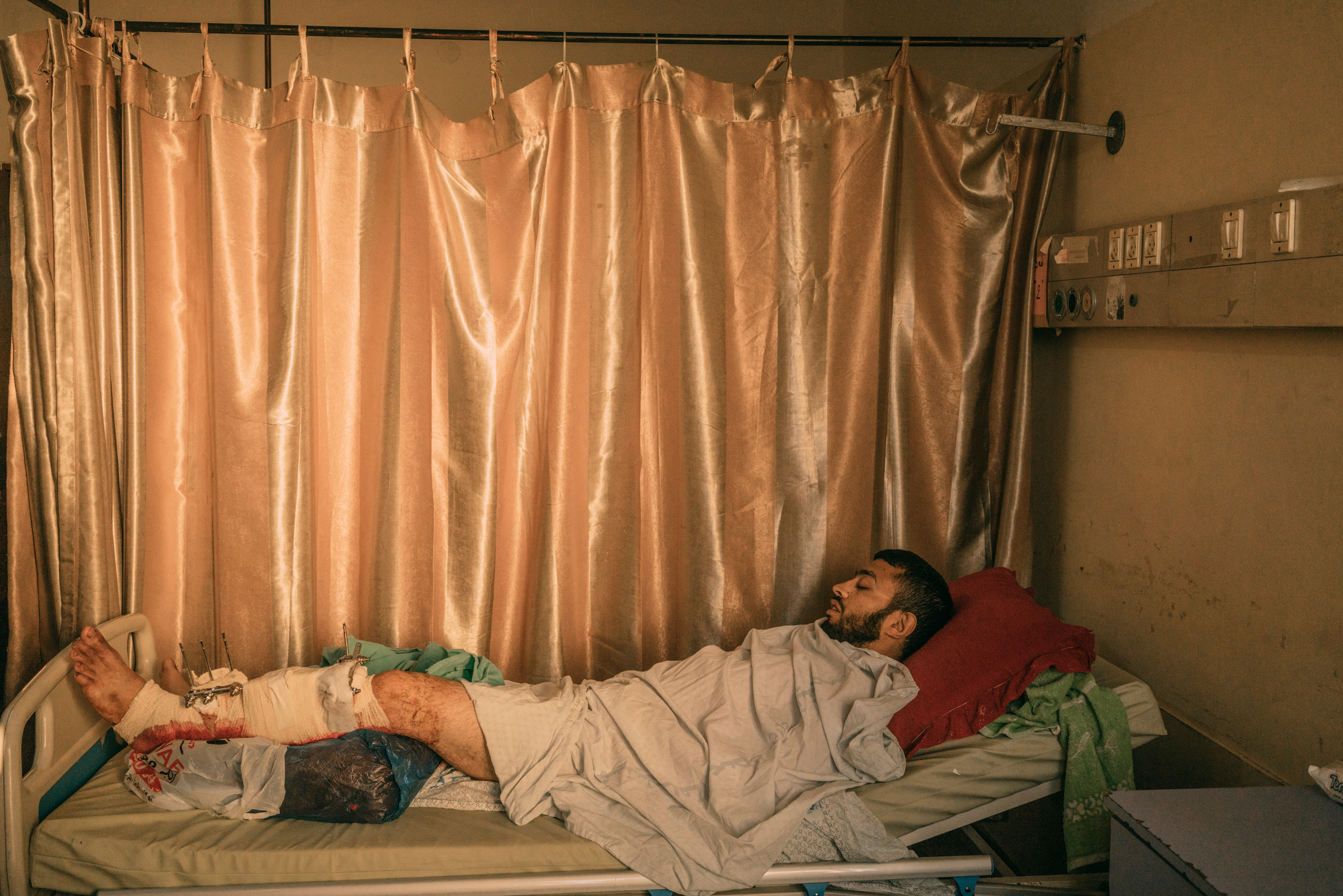 Ibrahim Dahir, 32, whose left leg was injured by Israeli troops during the protest, lays in a bed at Shifa Hospital in Gaza City. (Emanuele Satolli for TIME)