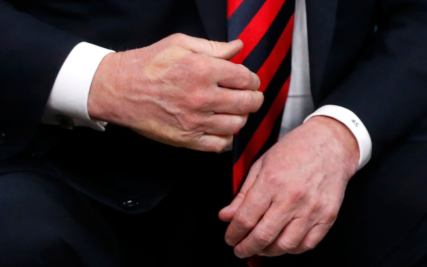 The imprint of French President Emmanuel Macron's thumb can be seen across the back of President Trump's hand after a handshake during a bilateral meeting at the G7 Summit in Canada on June 8, 2018. (Leah Millis—Reuters)