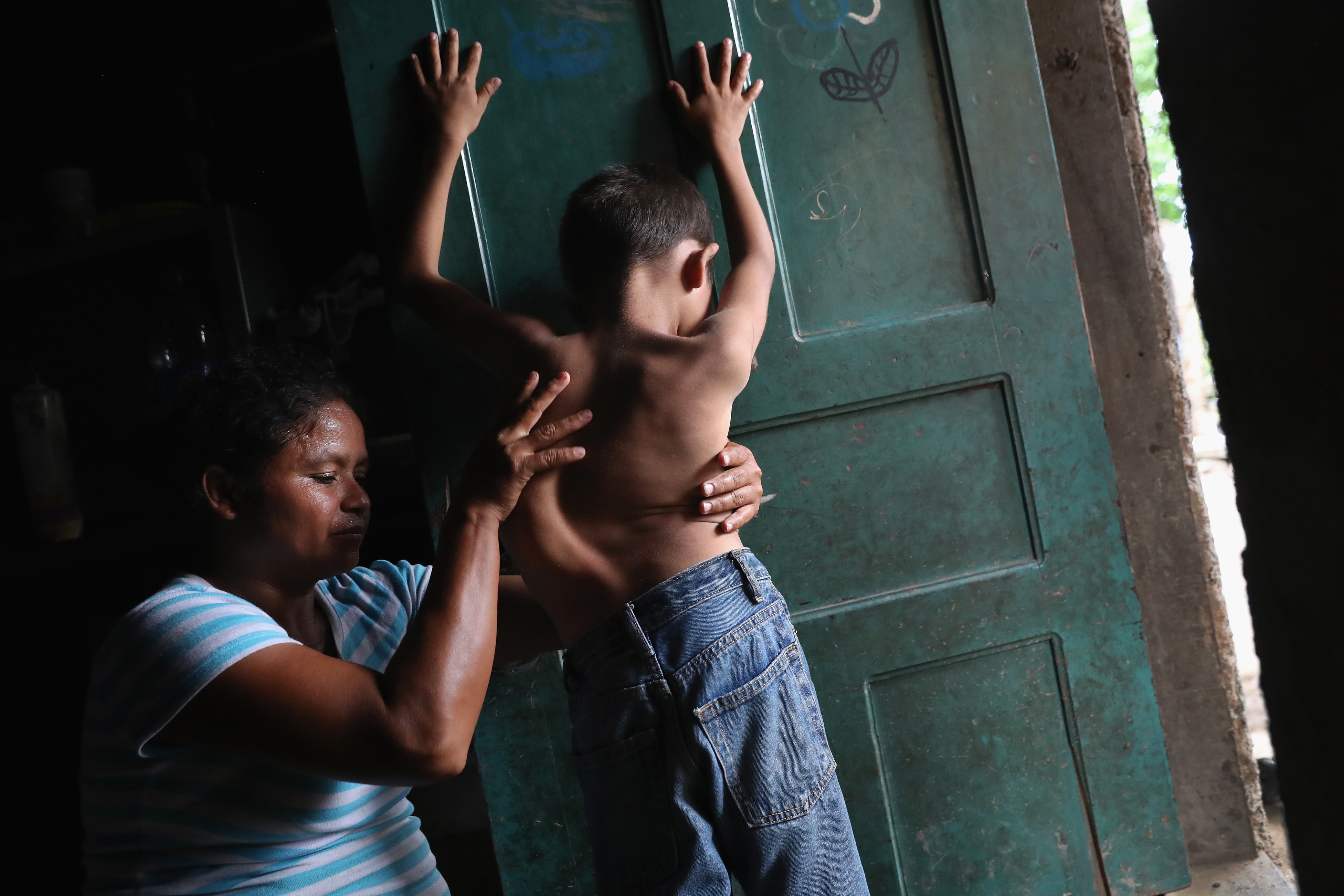 Sonia Morales massages the back of her son Jose Issac Morales, 11, at the door of their one-room home in San Pedro Sula, Honduras on Aug. 20, 2017. The mother of three said that her son's spinal deformation began at age four, but has never been able to afford the $6,000 surgery to correct his spinal condition. The boy's father, Issac Morales, 30, said he tried to immigrate to the U.S. in 2016 to work and send money home but was picked up by U.S. Border Patrol officers in the Arizona desert and deported back to Honduras. (John Moore—Getty Images)