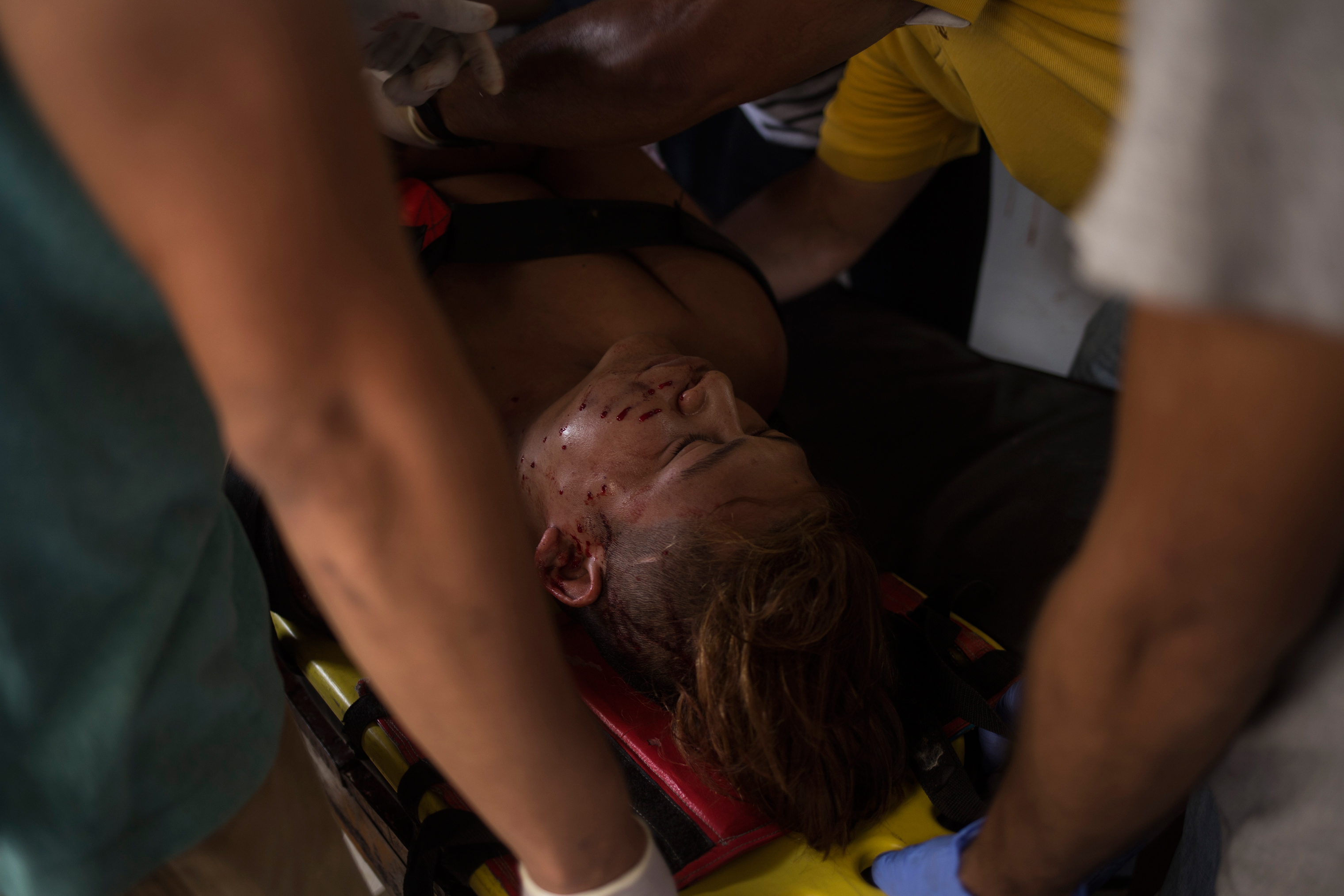 A demonstrator who was injured during a clash with police in Masaya on June 2. (Víctor Peña—El Faro)