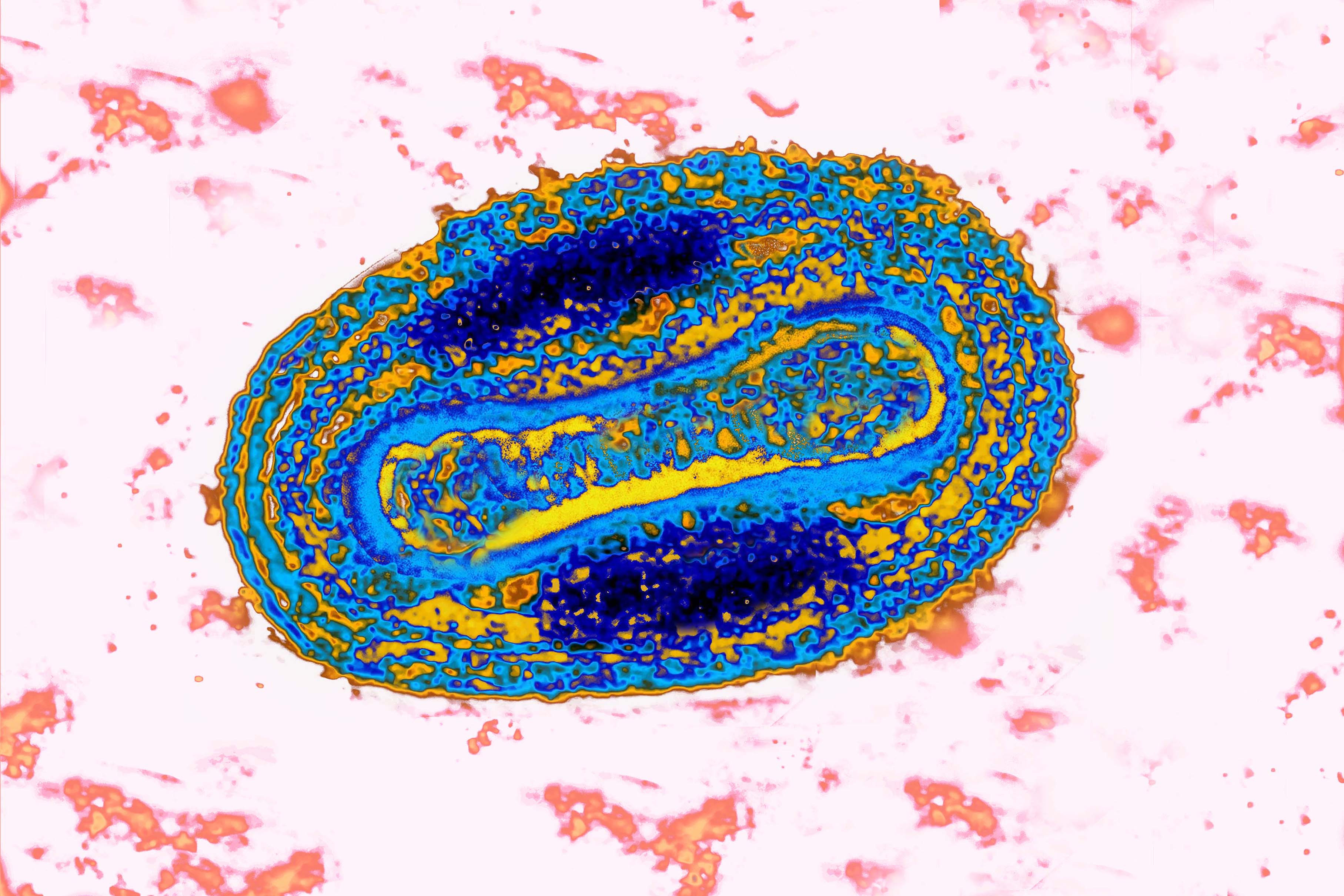 Variole Virus. (BSIP&mdash;UIG via Getty Images)