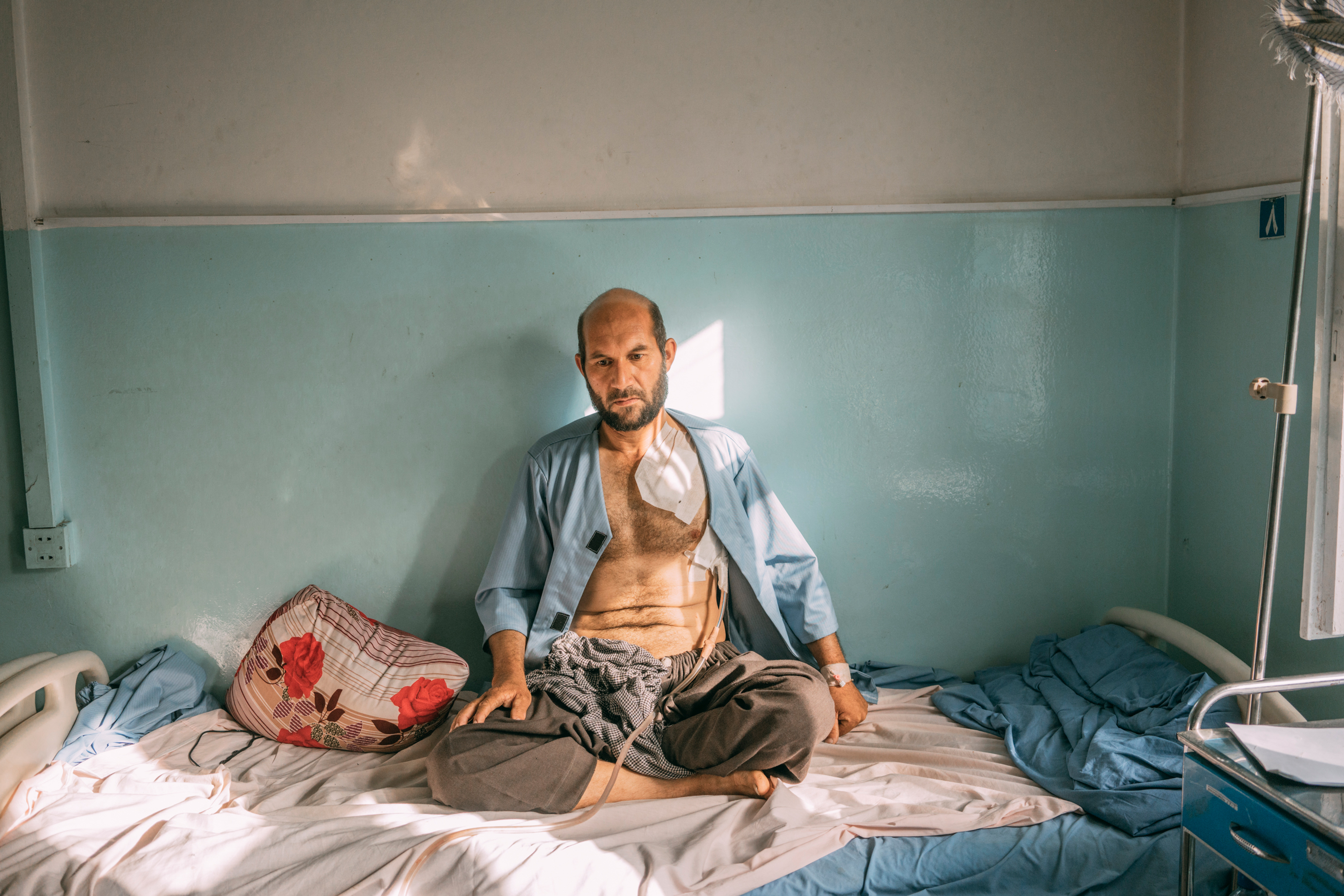 Nakibullah Salwary, 35, who was injured during the Taliban assault on Ghazni, sits on a hospital bed on Aug. 16. (Emanuele Satolli for TIME)