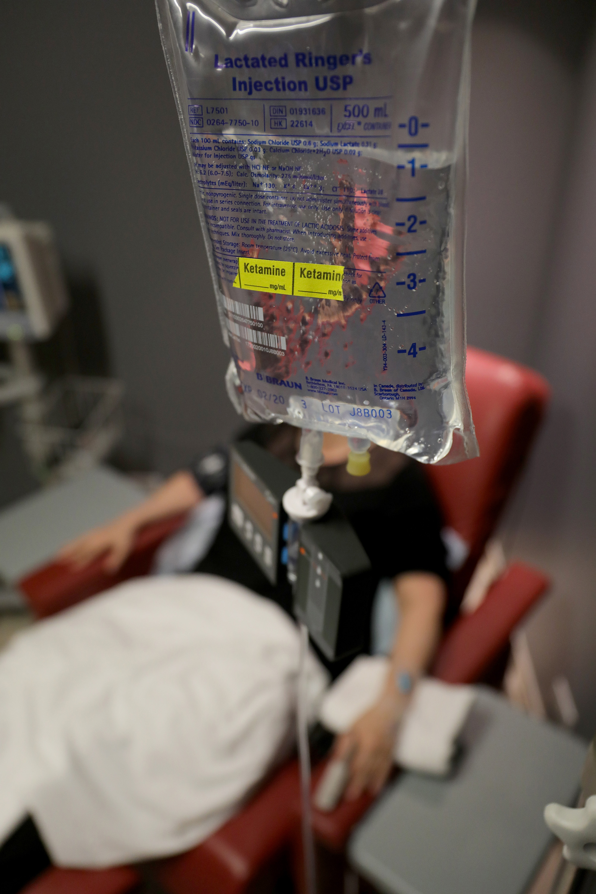 A patient has Ketamine administered by way of an  IV bag for the treatment of depression at IV Solution in Chicago, Wednesday, March 21, 2018. (Chicago Tribune—TNS via Getty Images)