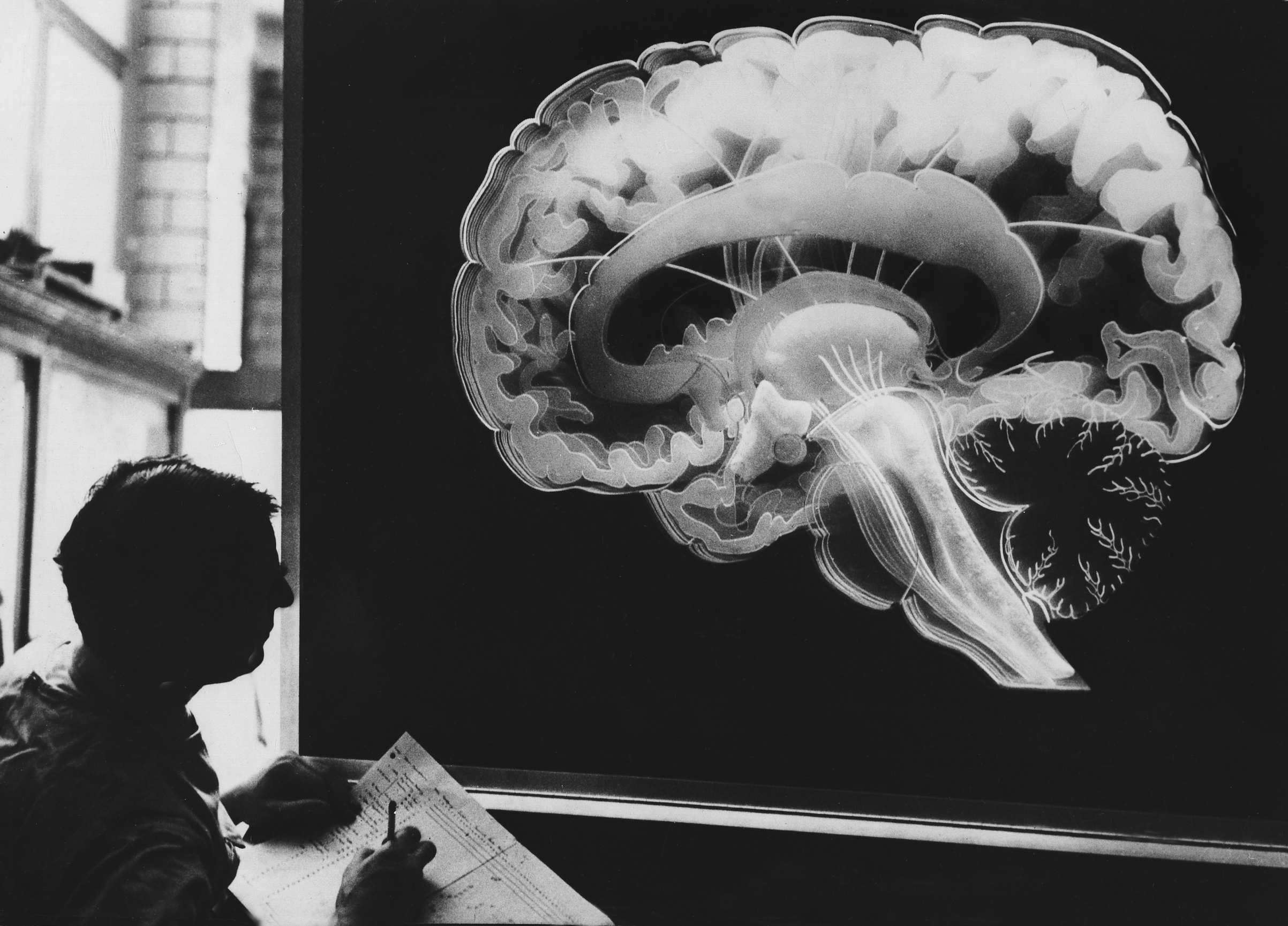 A plastic model of a human brain, Philadelphia, 1960. (ullstein bild via Getty Images)