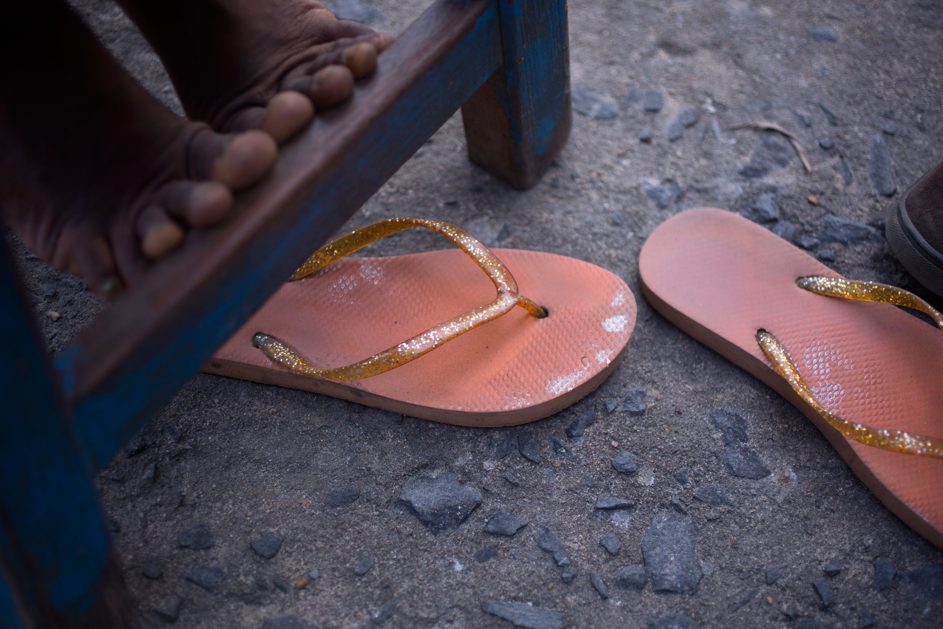 Feet of one of the girls who was in the trial. (Kathleen Flynn, special to ProPublica)