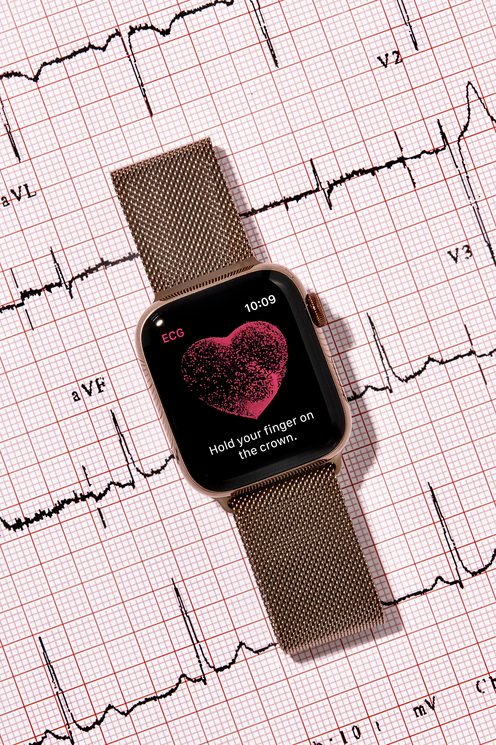 EKG apple watch healthcare technology 1