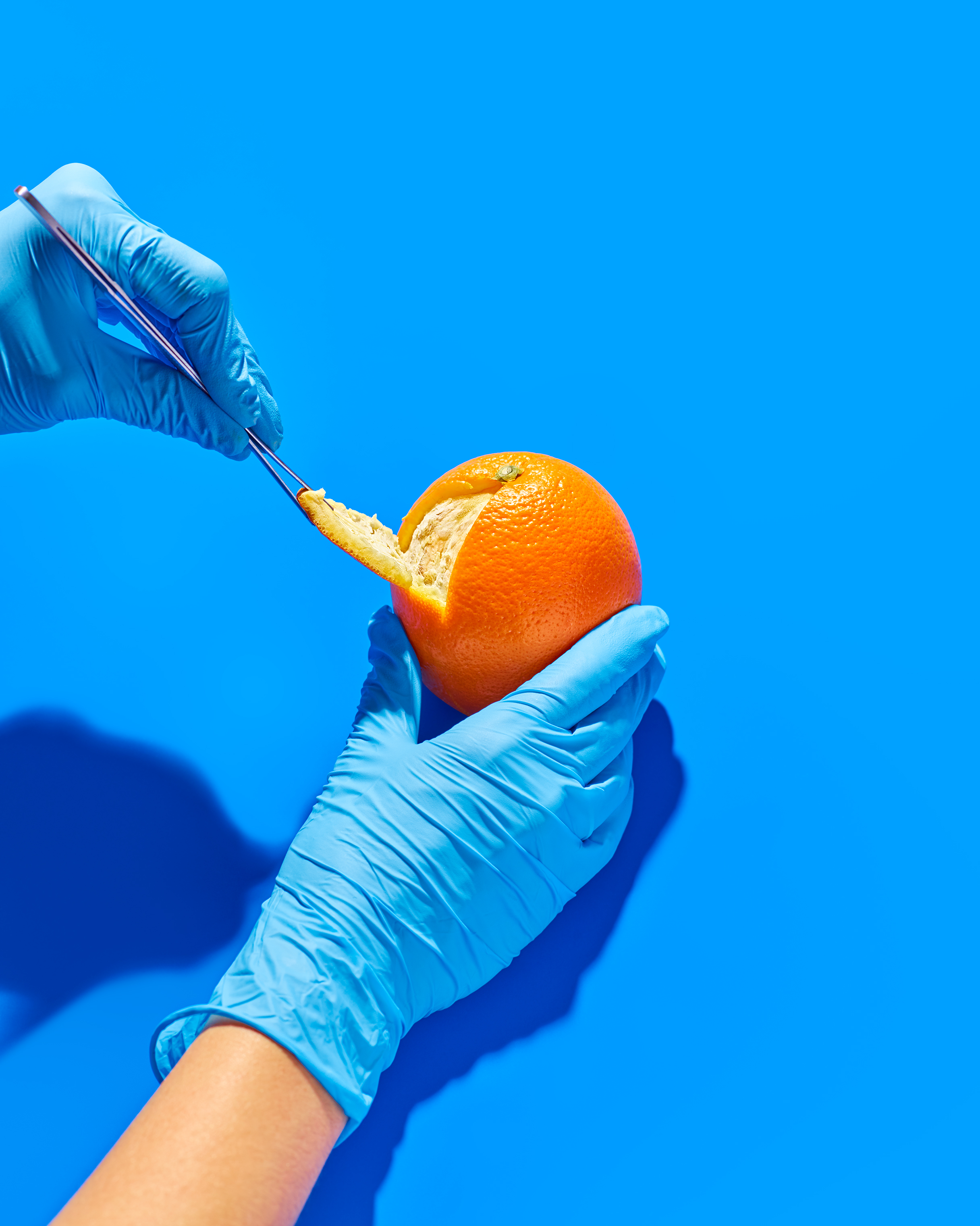 ORANGES | Rich in vitamin C, which can increase the production of certain immune cells in the body. These cells can control overactive immune reactions in autoimmune diseases like lupus (Zachary Zavislak for TIME)