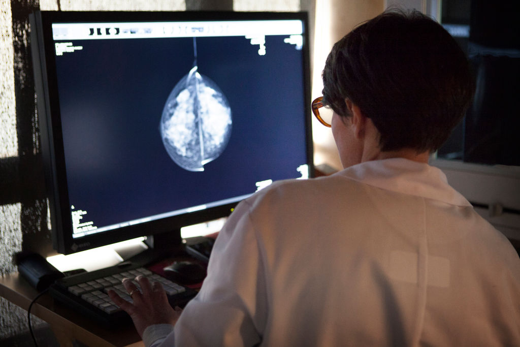 A radiologist looks at the results of mammograms in France. (BSIP&mdash;UIG via Getty Images)