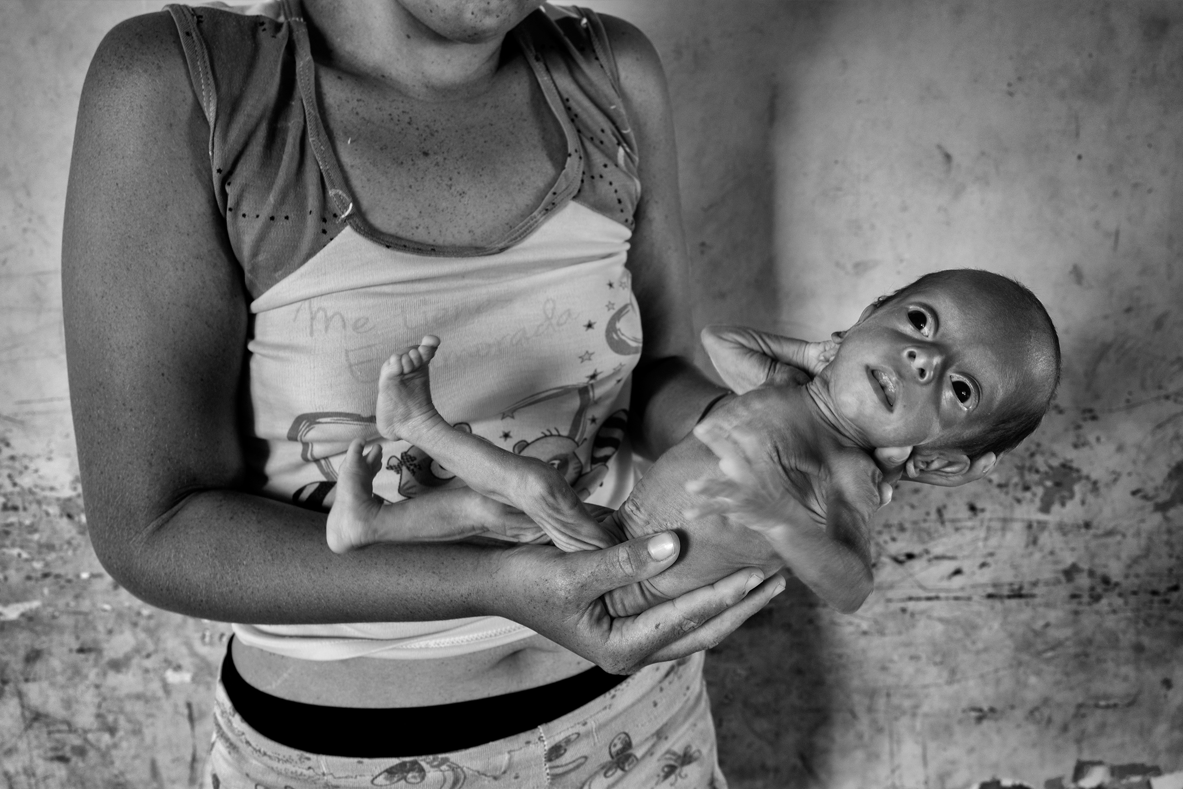 Katherine Castilla, 19, holds her baby girl Sarangeli, who suffers from malnutrition. Castilla lives in the same neighborhood as Blanco. (Alvaro Ybarra Zavala—Getty Images Reportage)