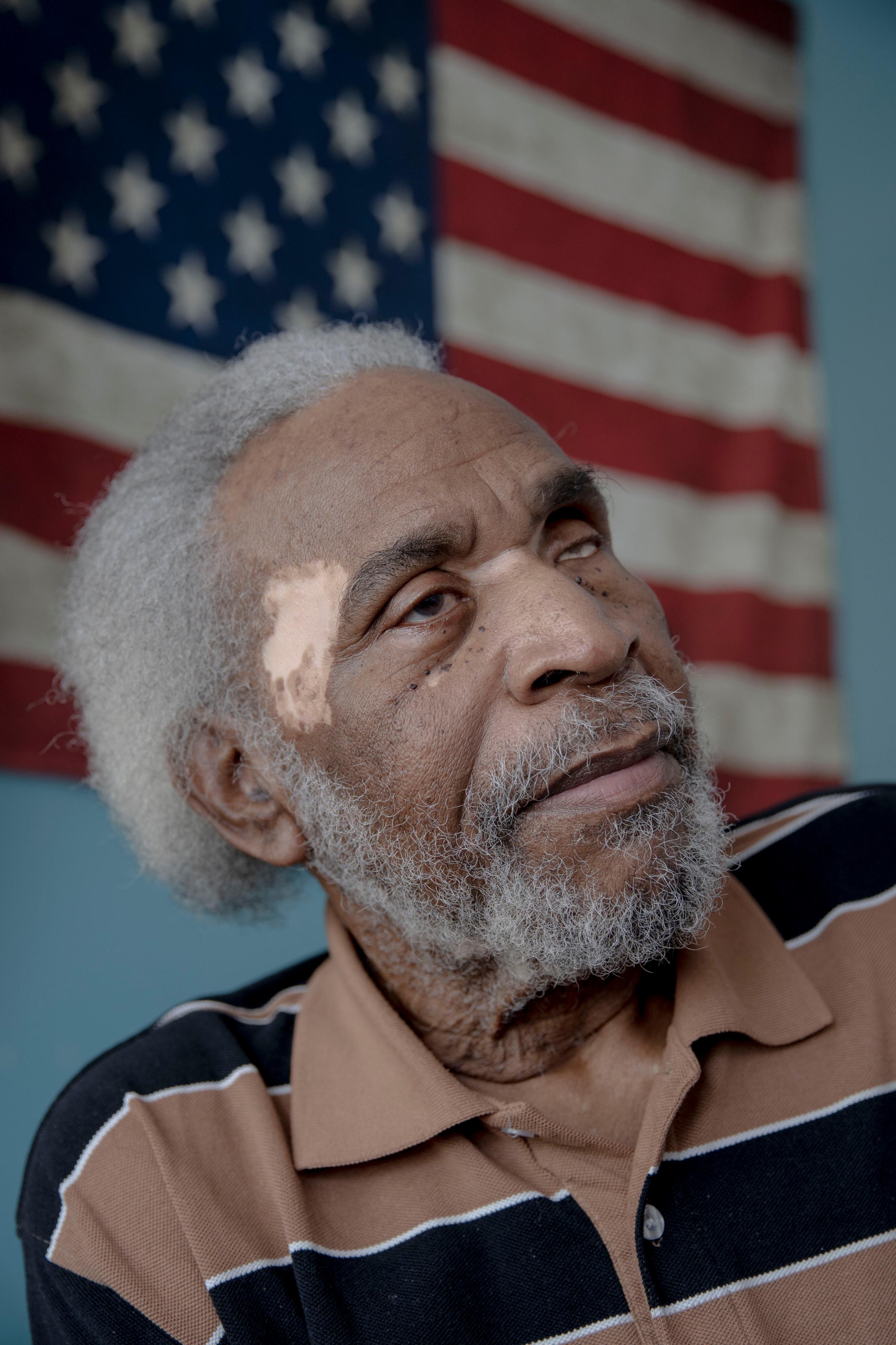 “Many times, I’ve felt like I was starving,” says veteran Eugene Milligan who is blind, lost half his right leg to diabetes, gets dialysis for kidney failure and has struggled to get enough to eat at his Memphis home. (Andrea Morales for Kaiser Health News)