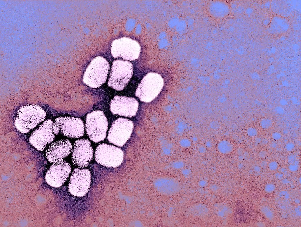 Smallpox Virus, A Serious, Highly Contagious, And Sometimes Fatal Infectious Disease. (BSIP&mdash;Universal Images Group via Getty)