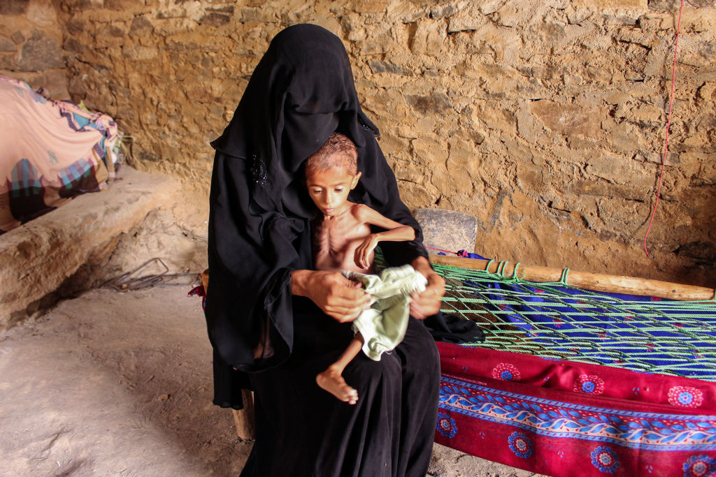 Moaz Ali Mohammed, a two-year-old Yemeni boy from an impoverished family in the Bani Amer region, who suffers from acute malnutrition and weighing eight kilograms, sits on his mother's lap at their house in the Aslam district in the northern Hajjah province on July 28, 2019. (ESSA AHMED—AFP/Getty Images)