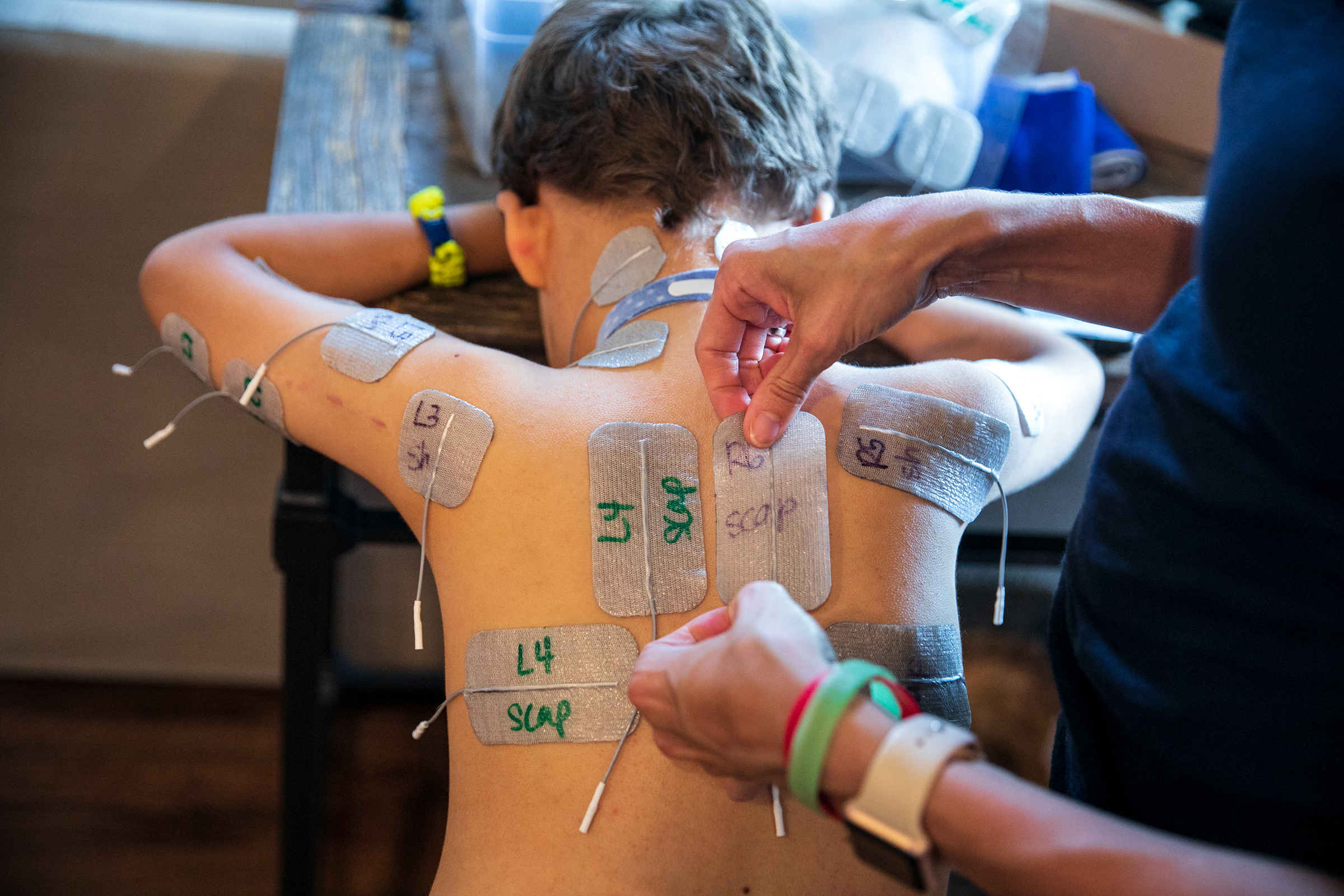 Muscle-stimulating pads are placed on Braden's back for treatment.