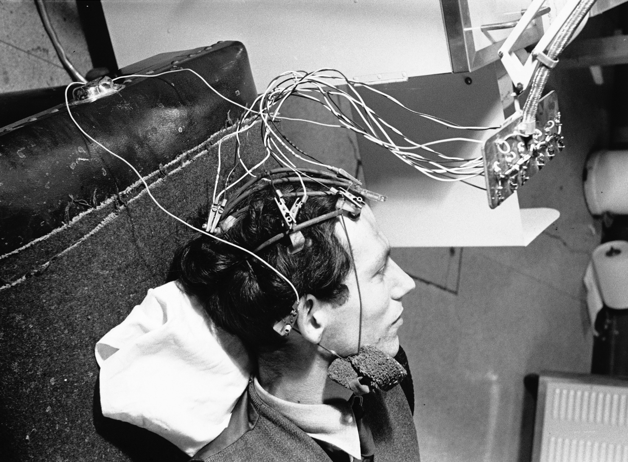 A machine measures the electrical brain activity of a man with epilepsy in 1950 (Corbis/Getty Images)